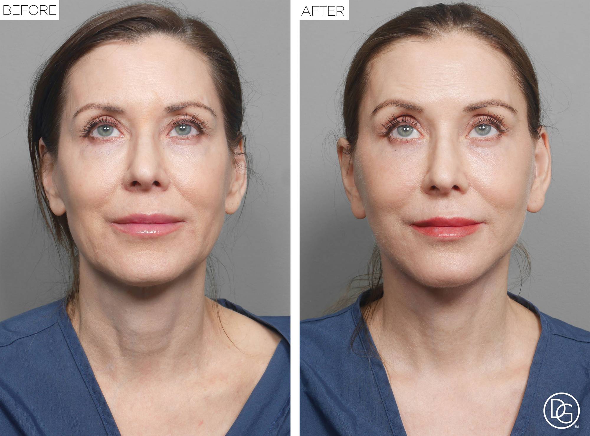 Before & After Image