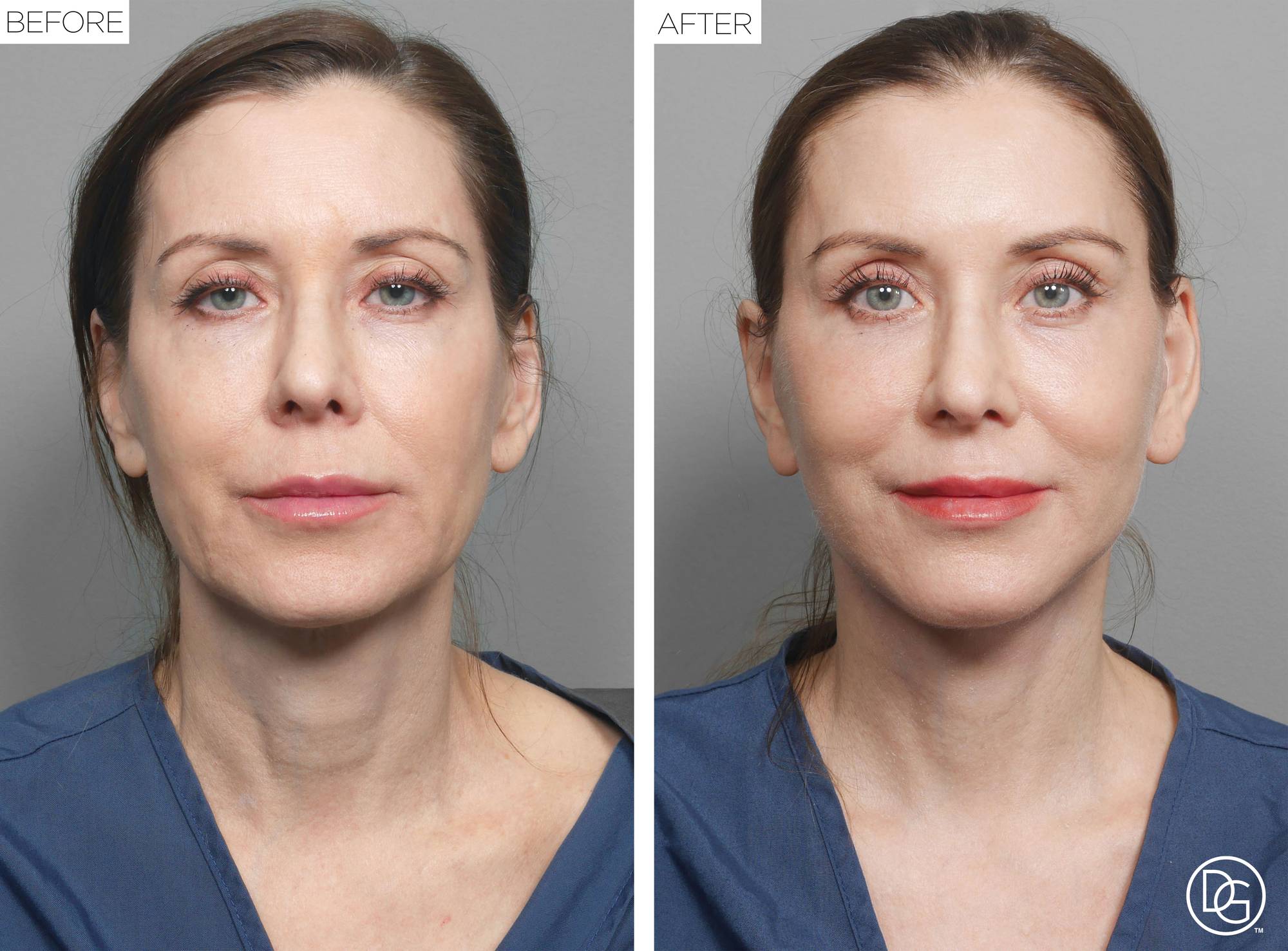 Before & After Image