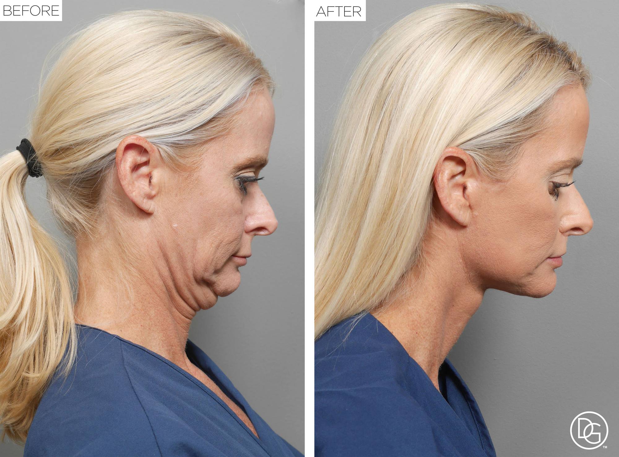 Before & After Image