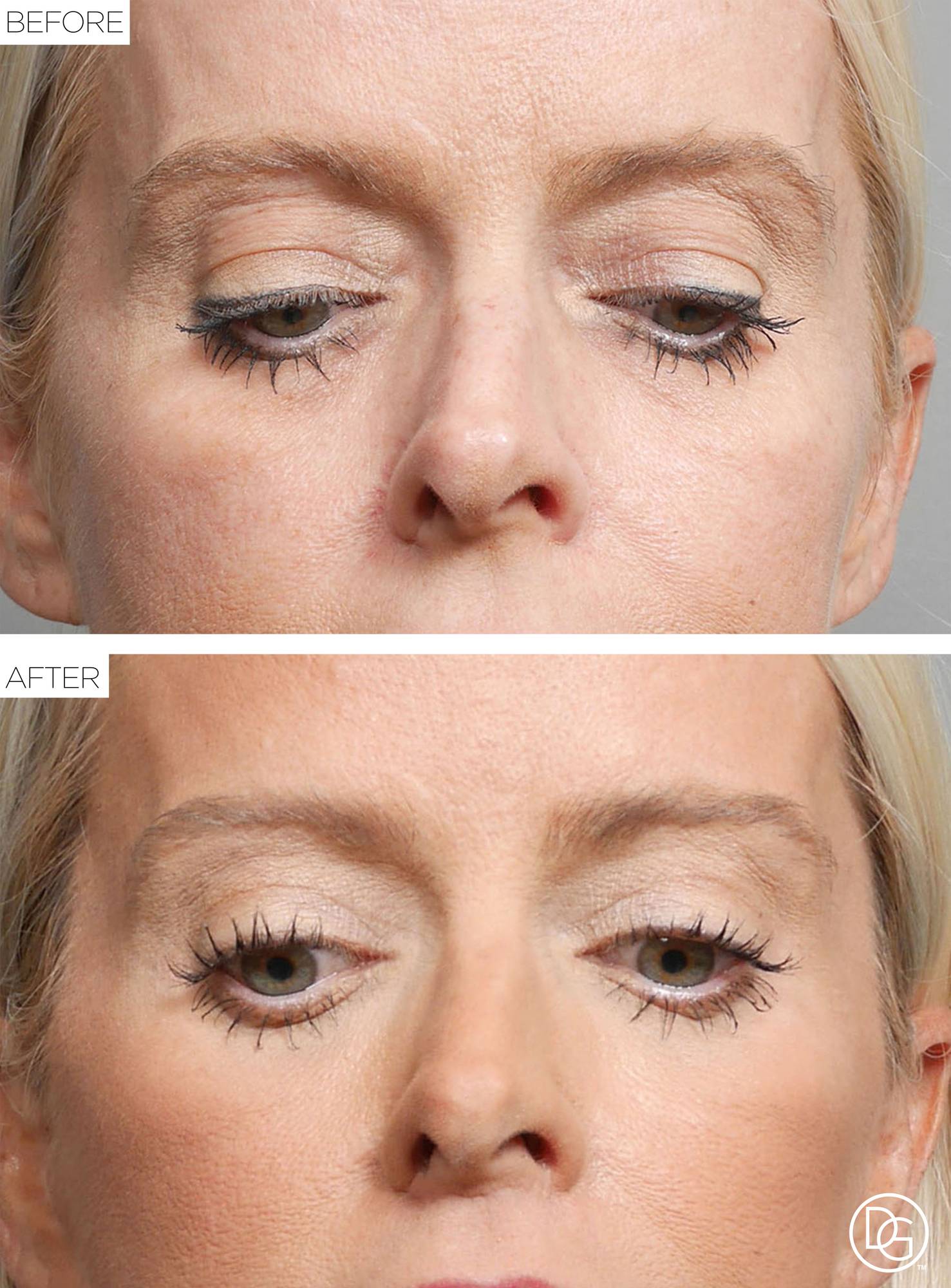 Before & After Image