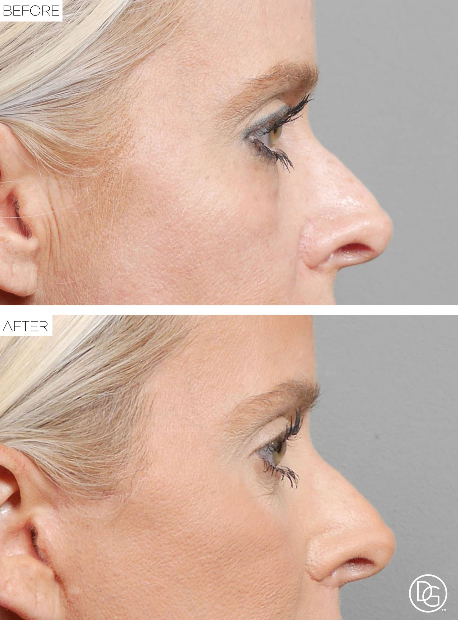 Before & After Image