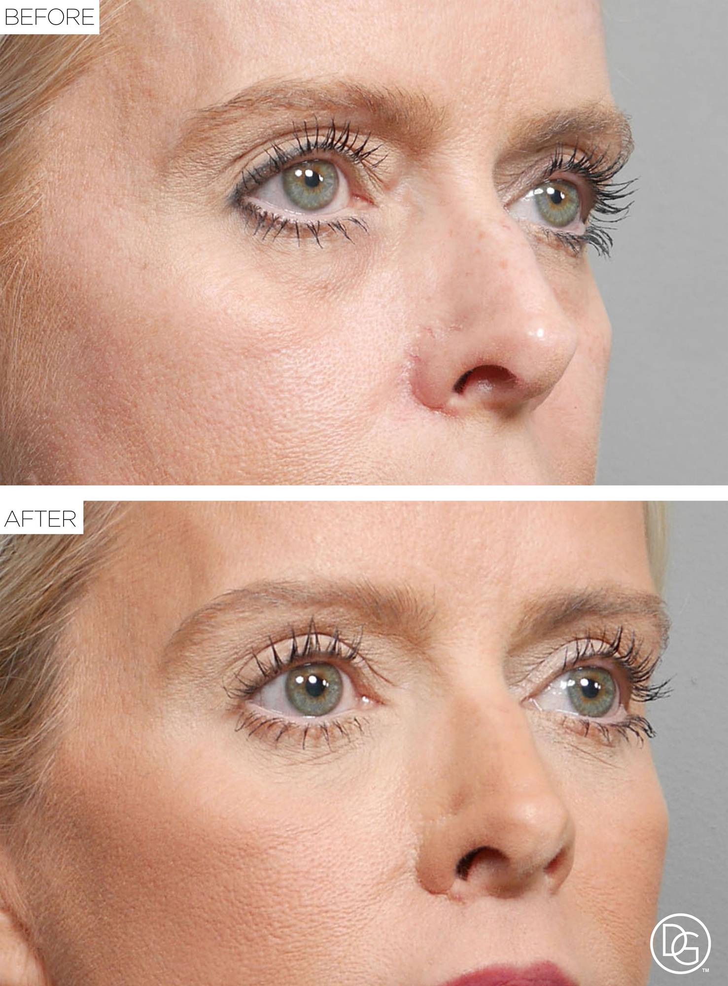 Before & After Image