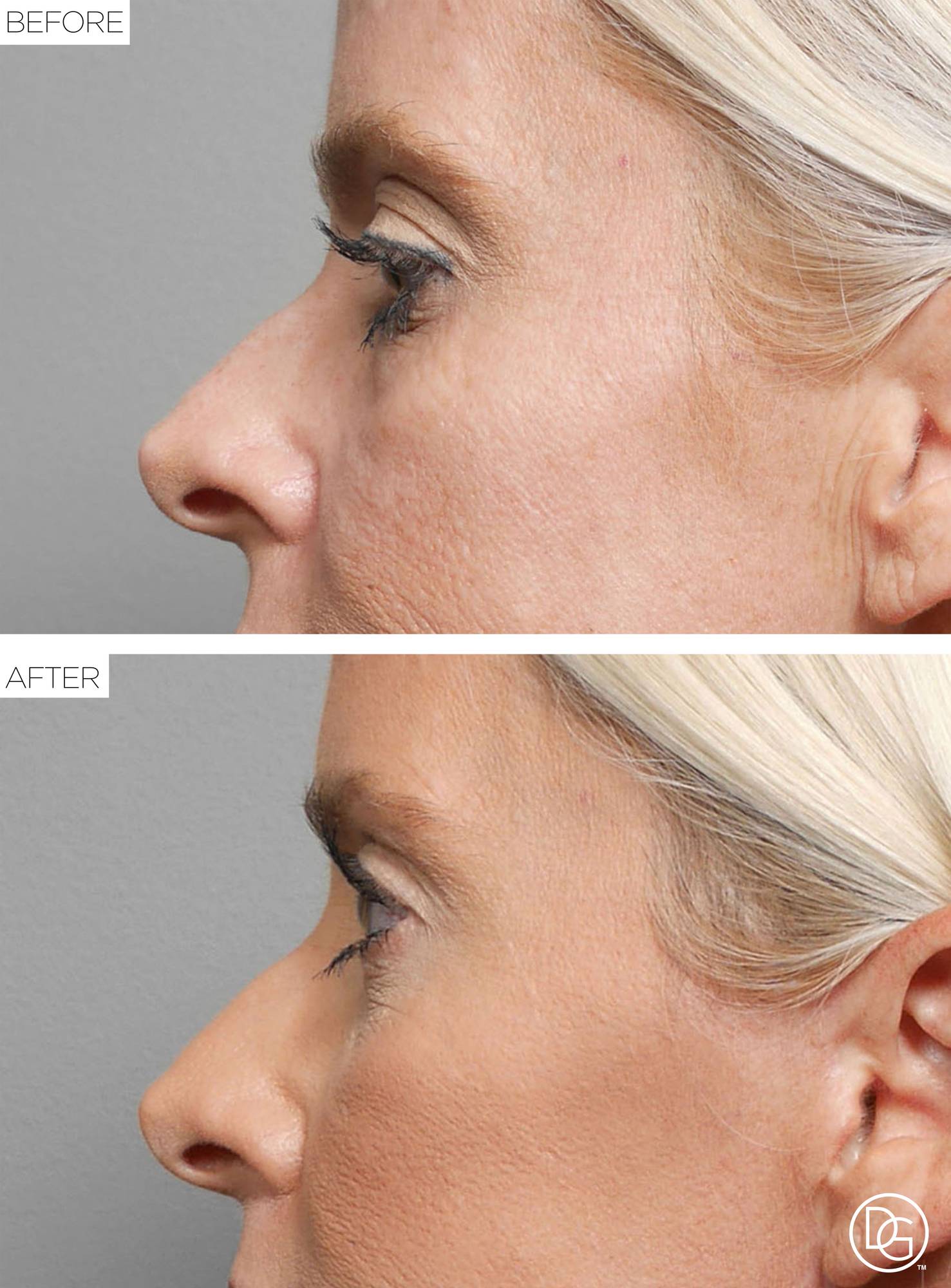Before & After Image