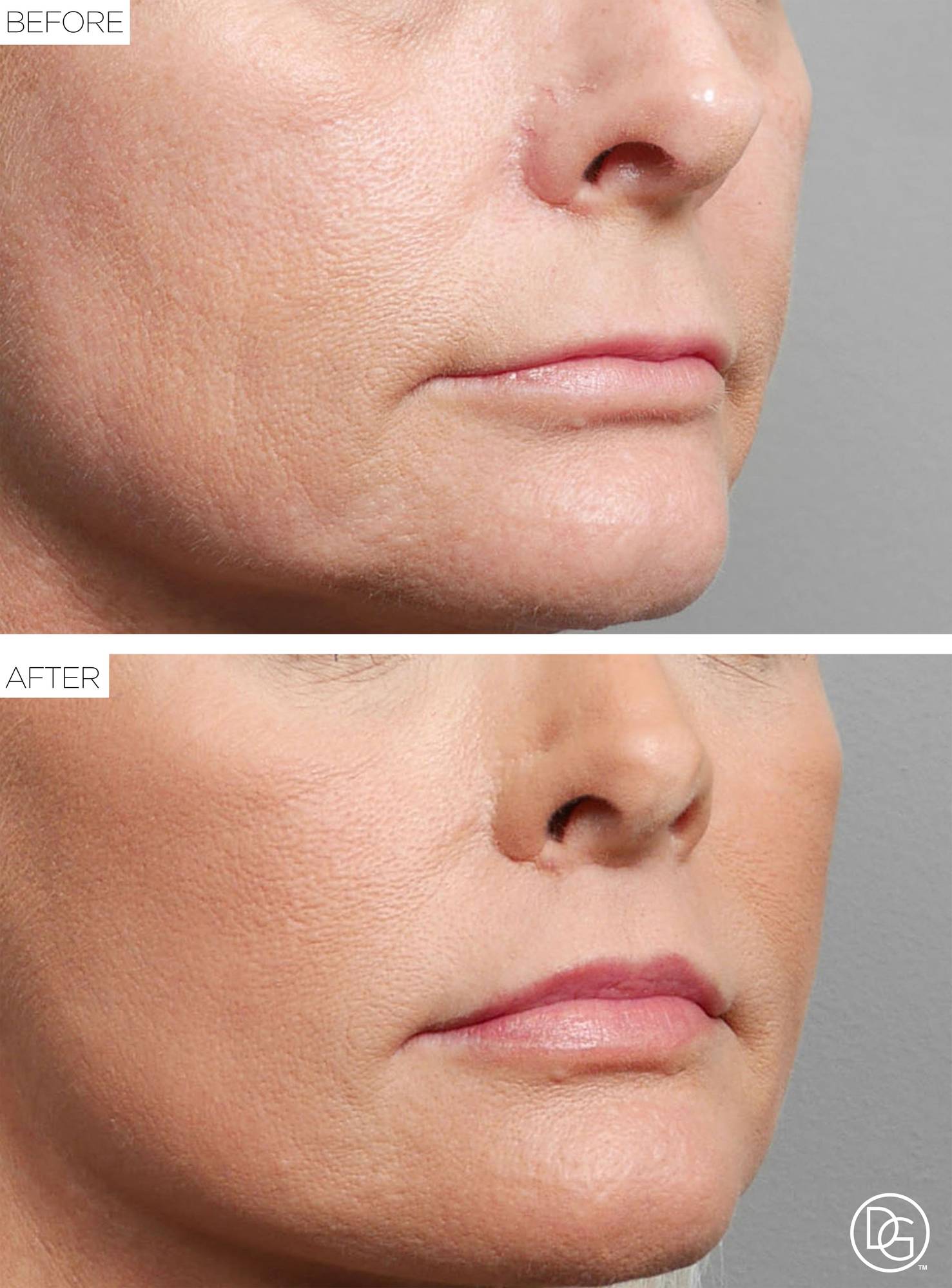 Before & After Image