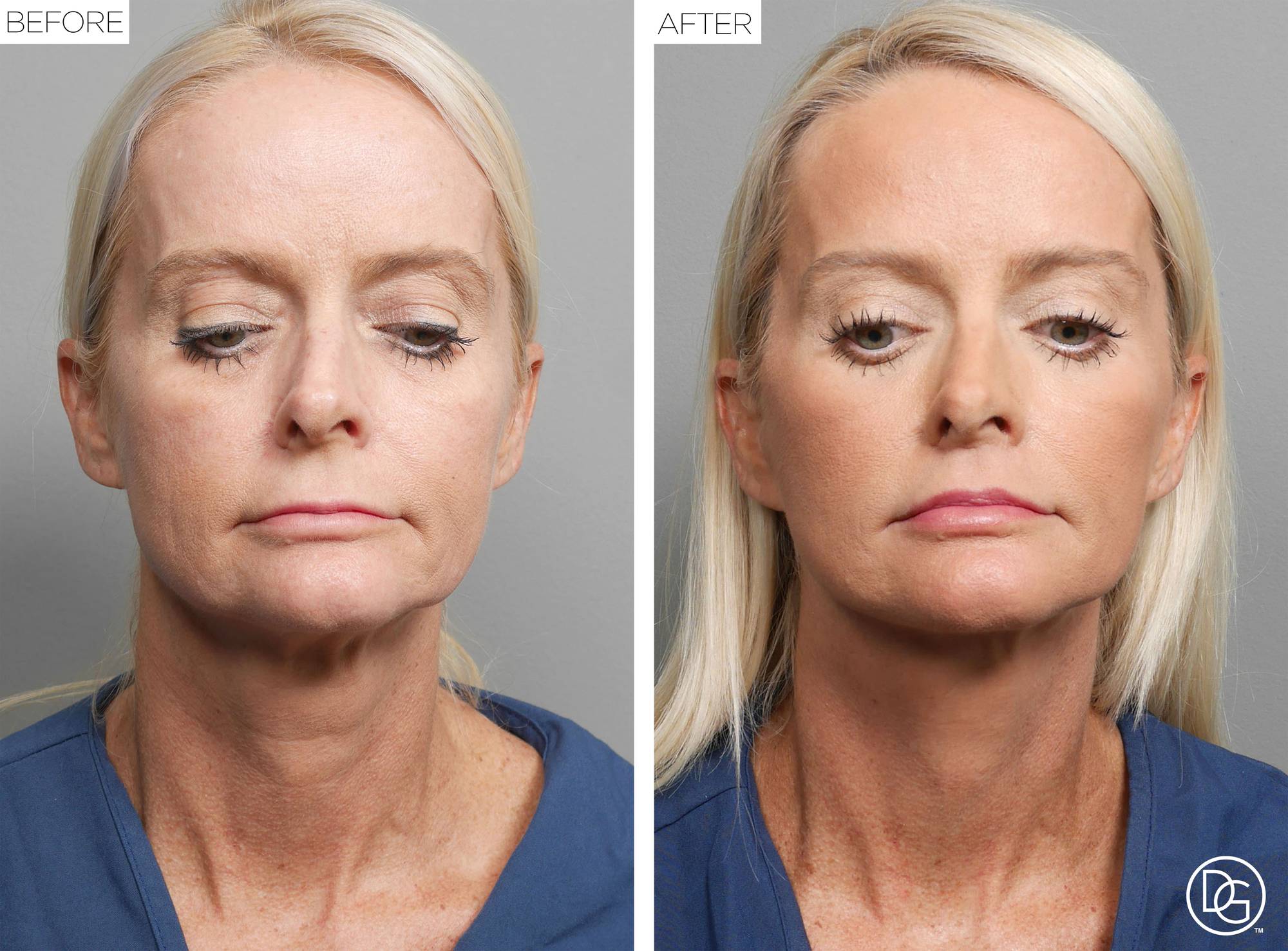 Before & After Image