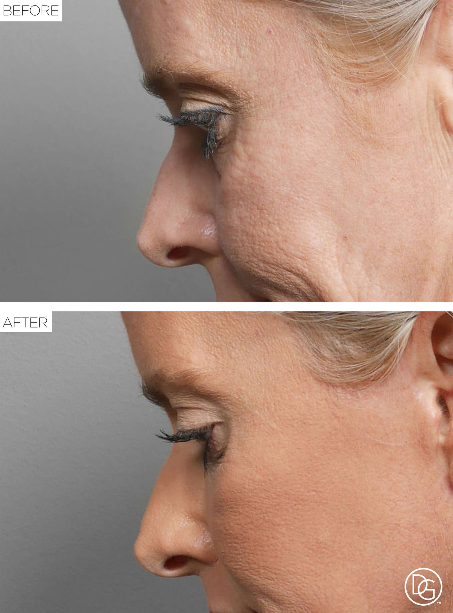 Before & After Image