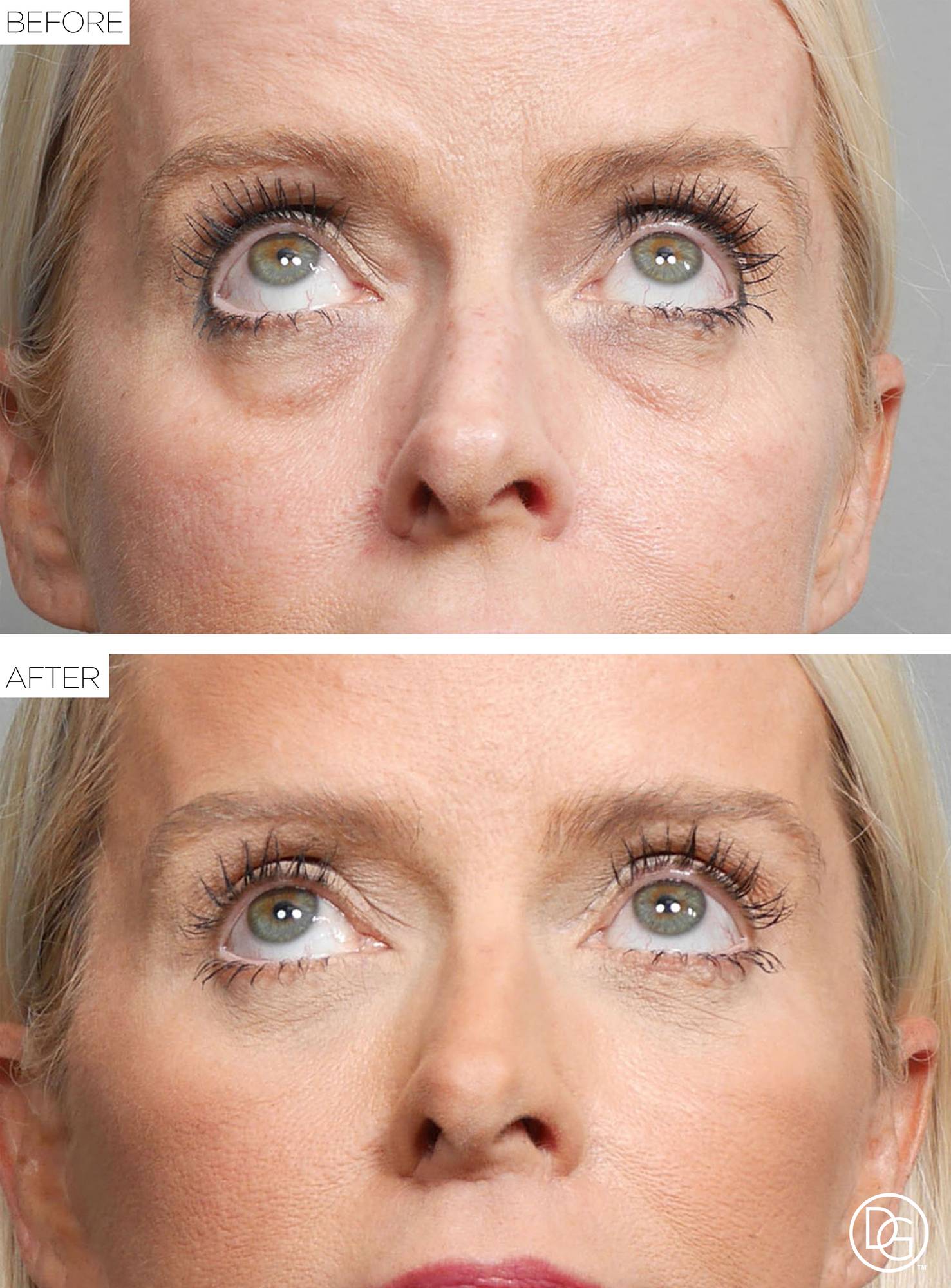 Before & After Image