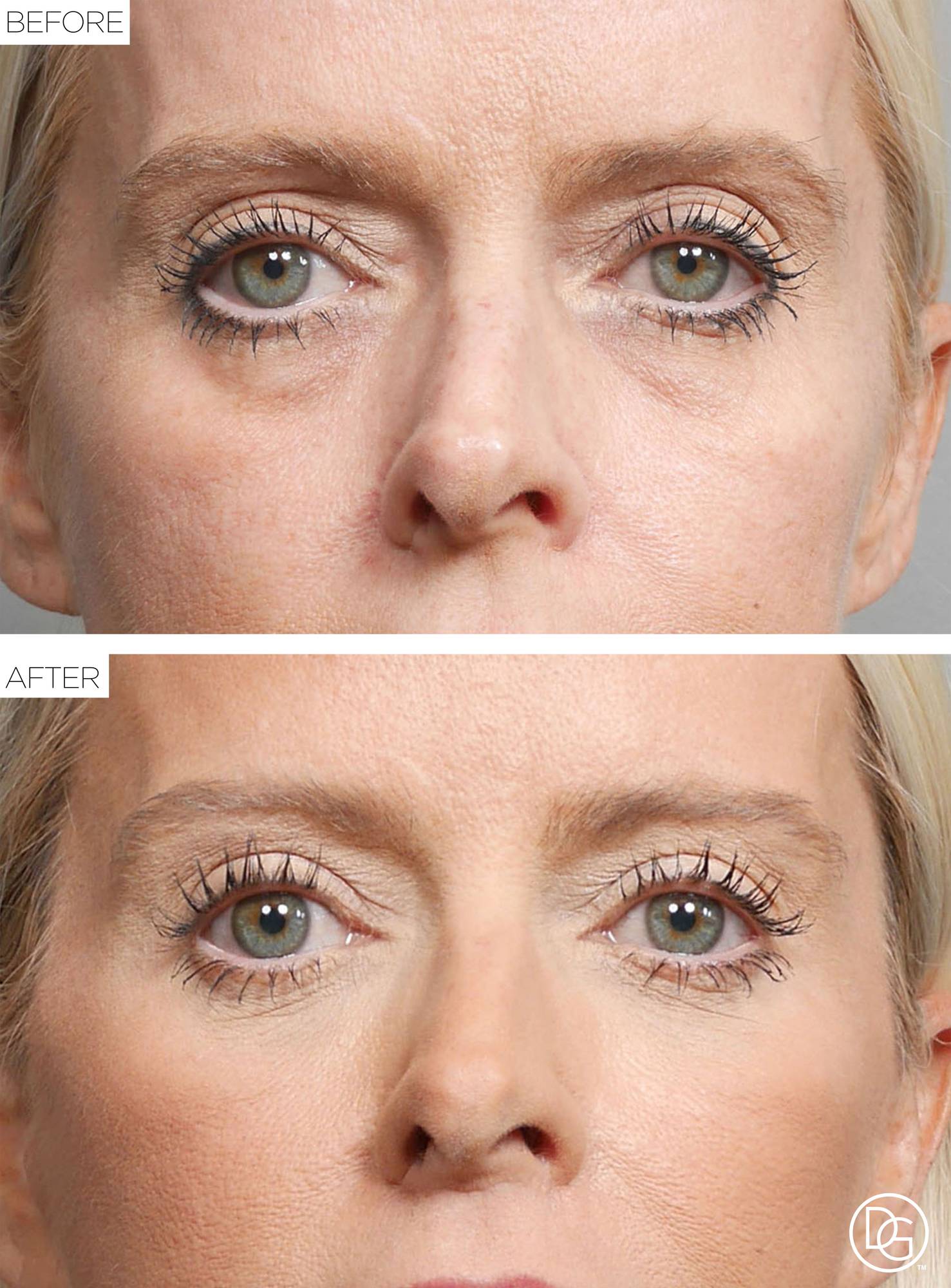 Before & After Image