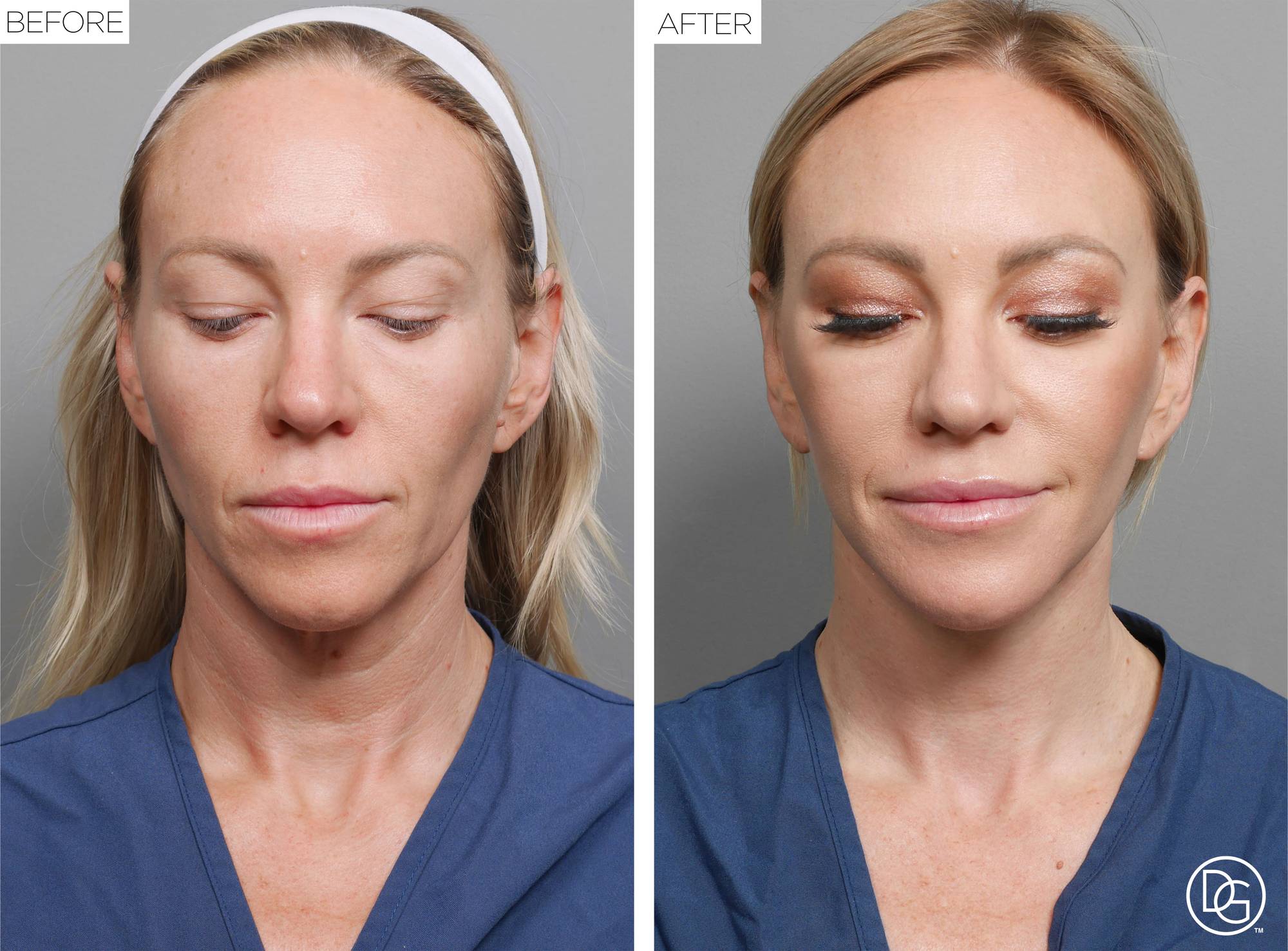 Before & After Image