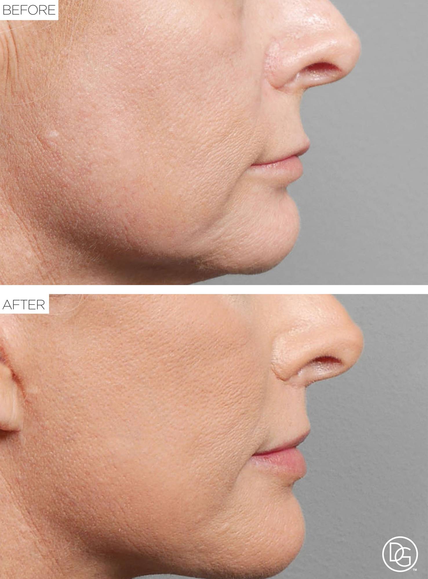 Before & After Image