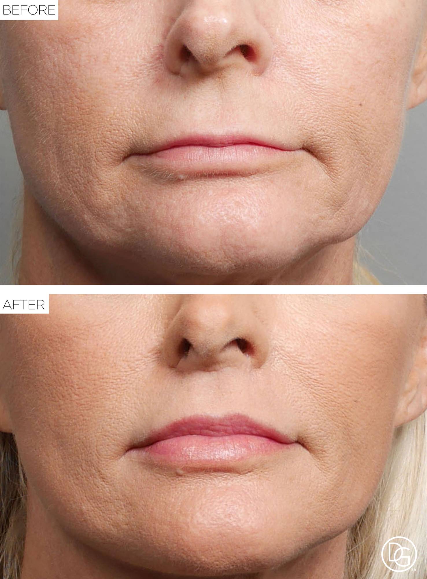 Before & After Image
