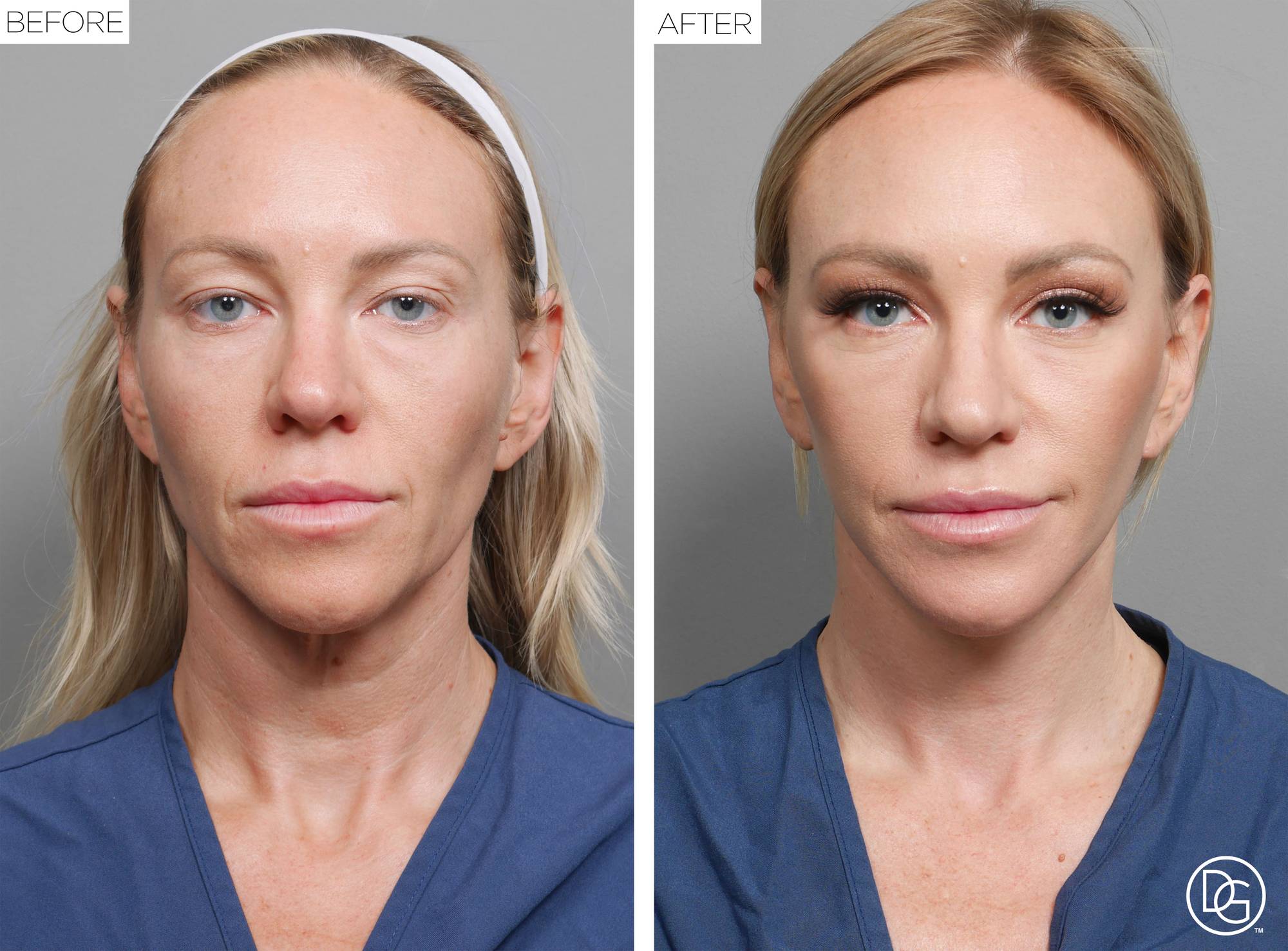 Before & After Image