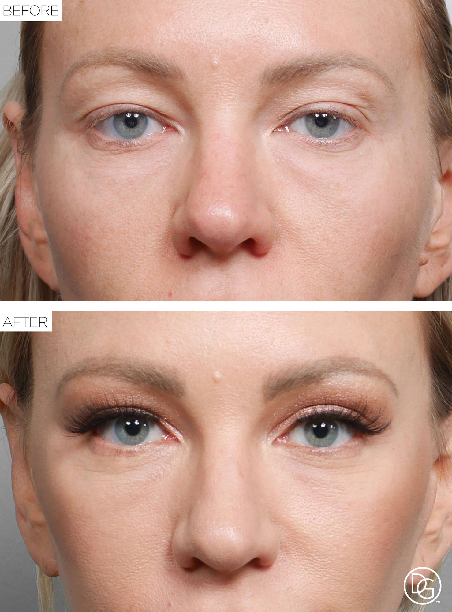 Before & After Image