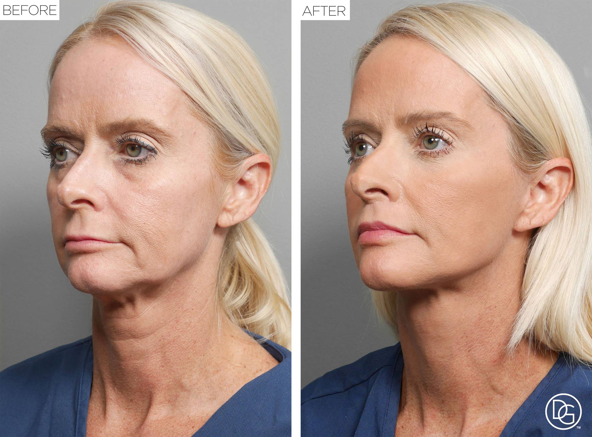Before & After Image