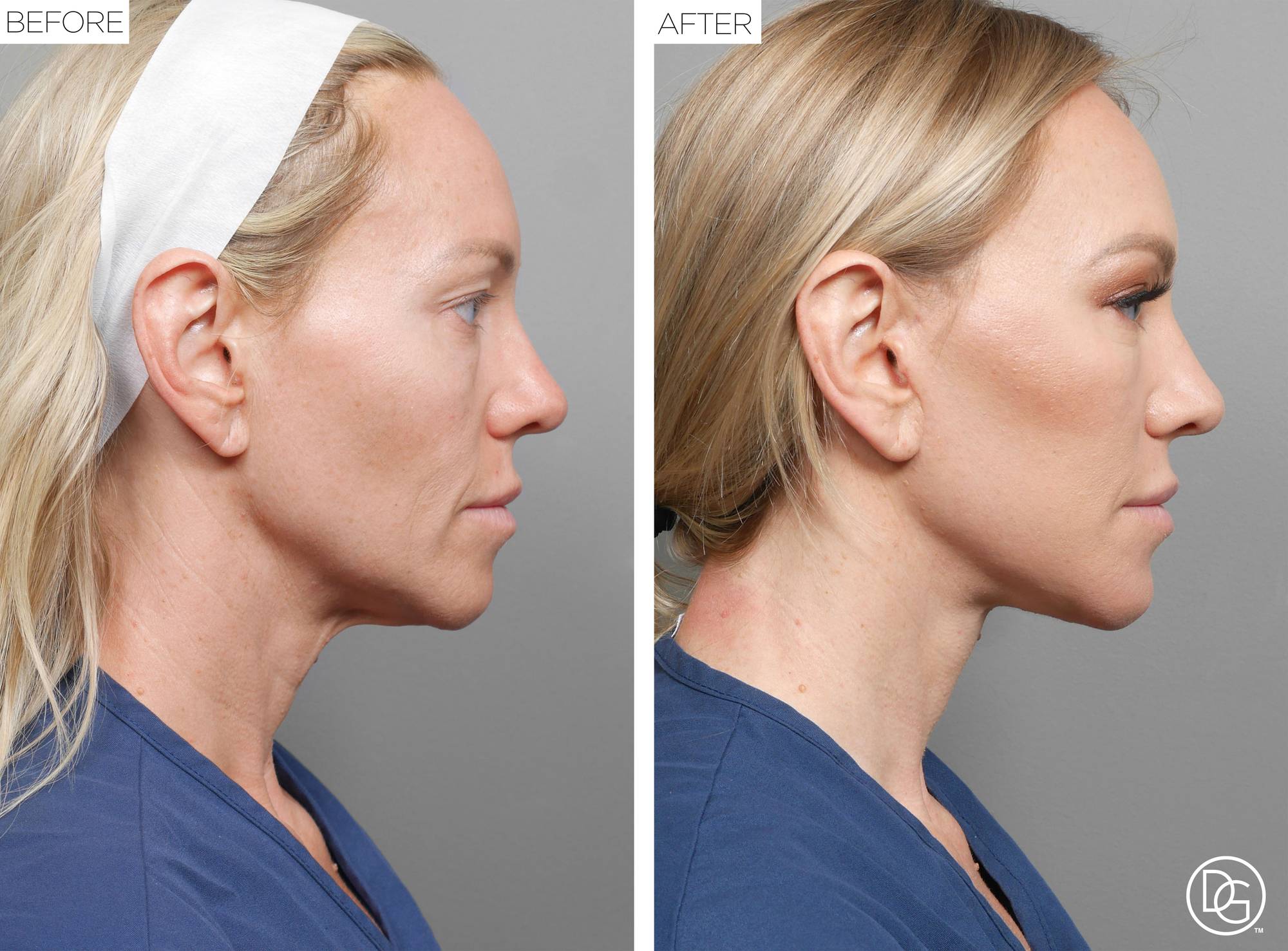 Before & After Image