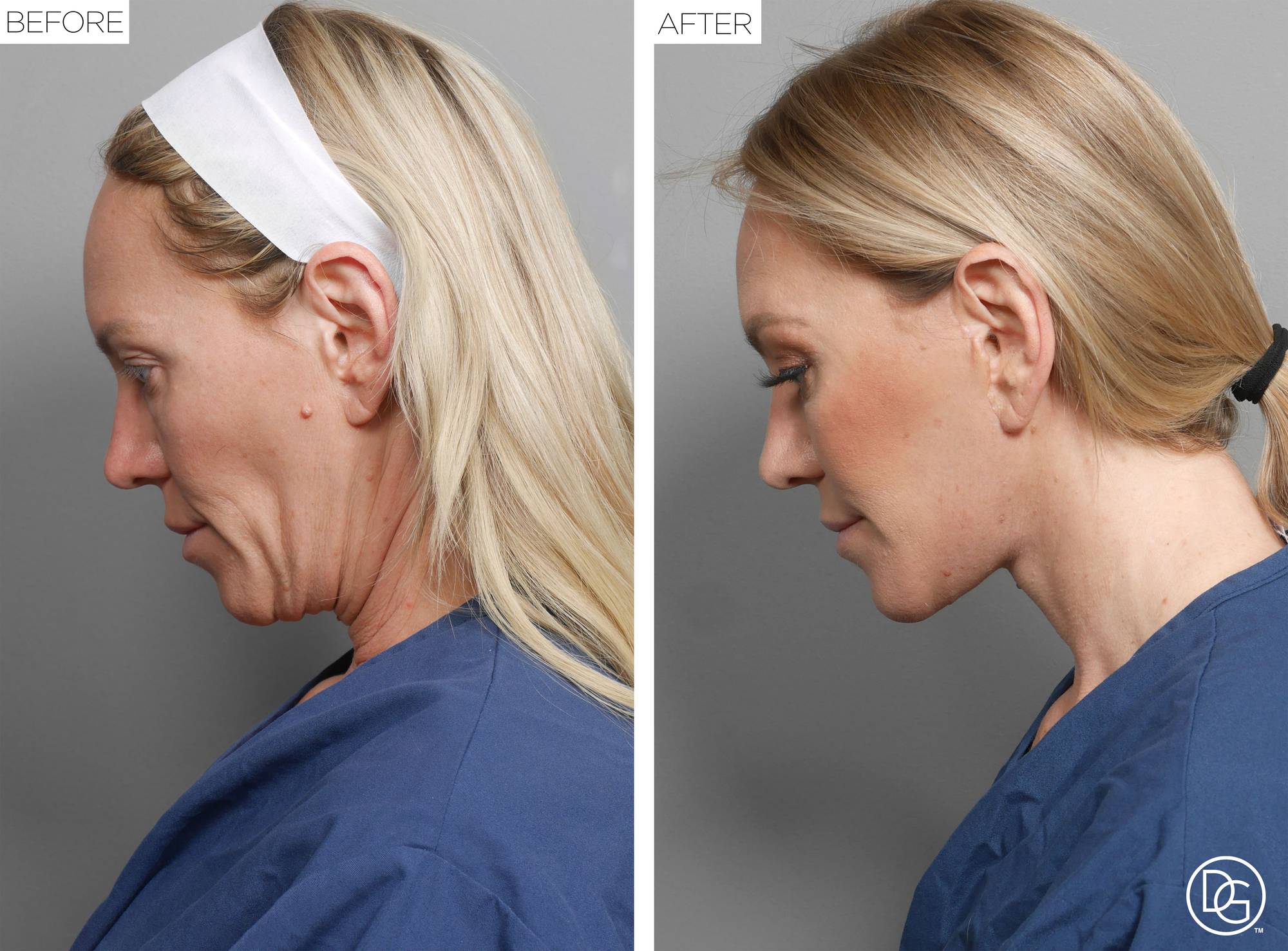 Before & After Image