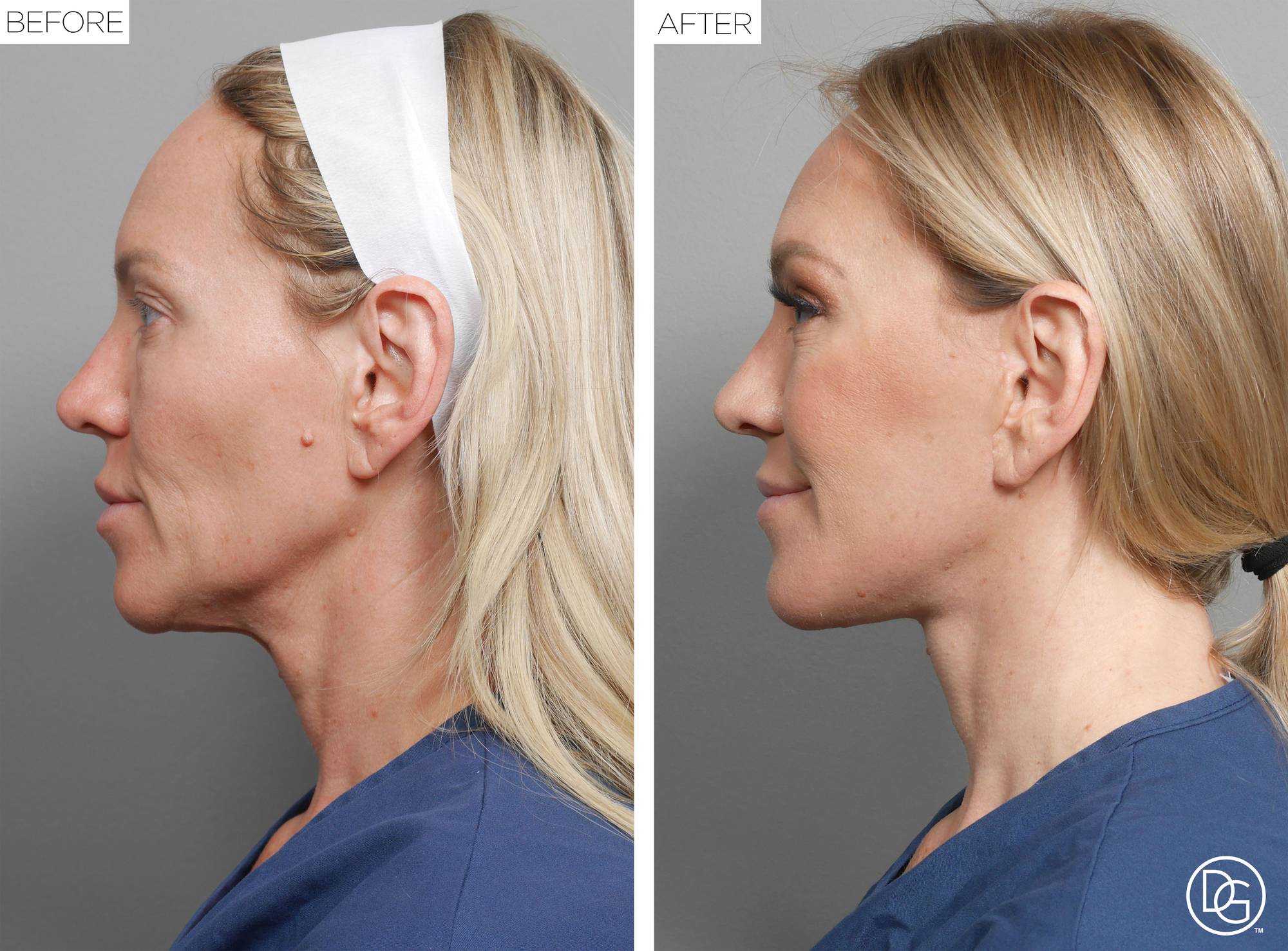 Before & After Image