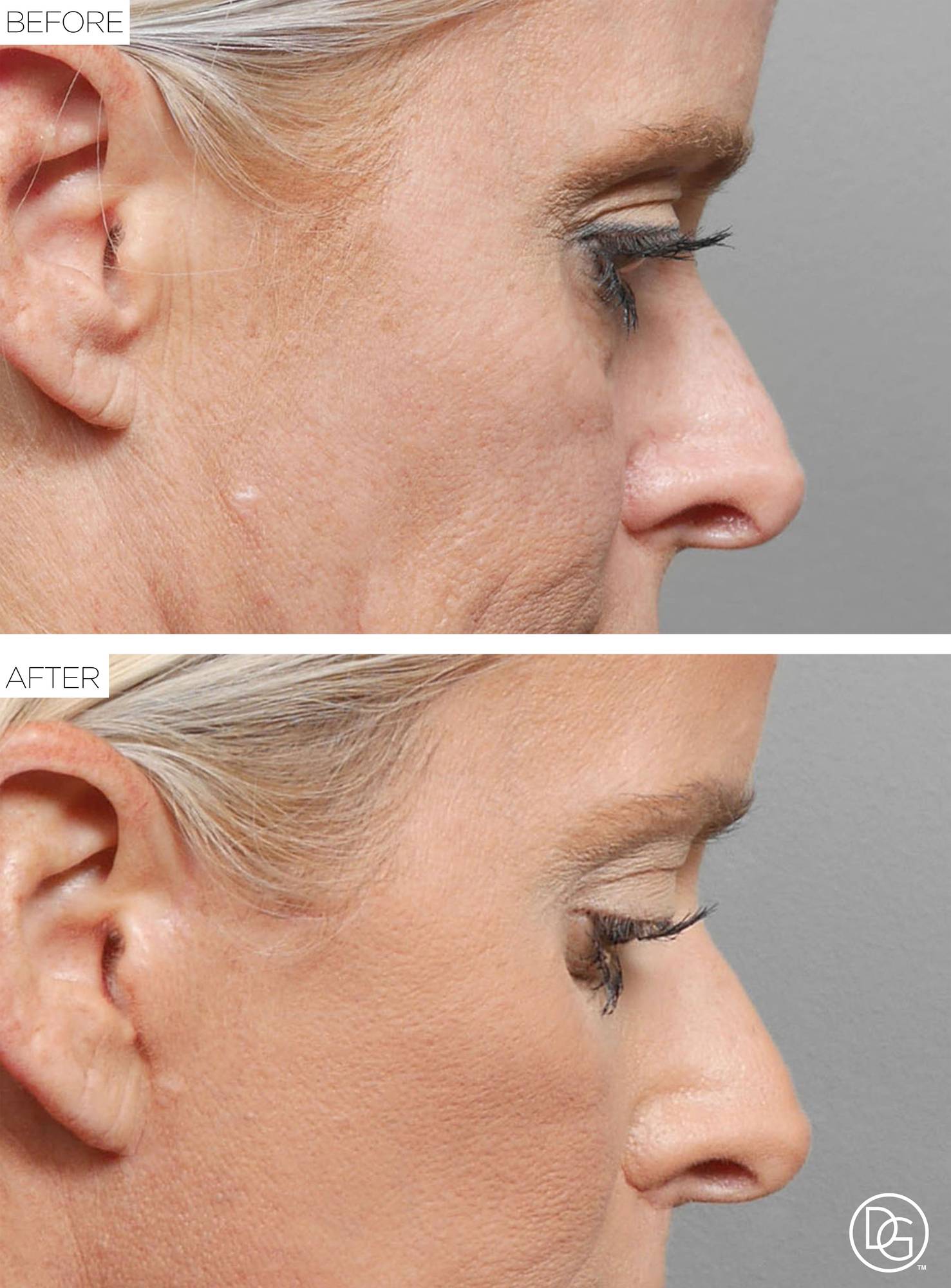 Before & After Image