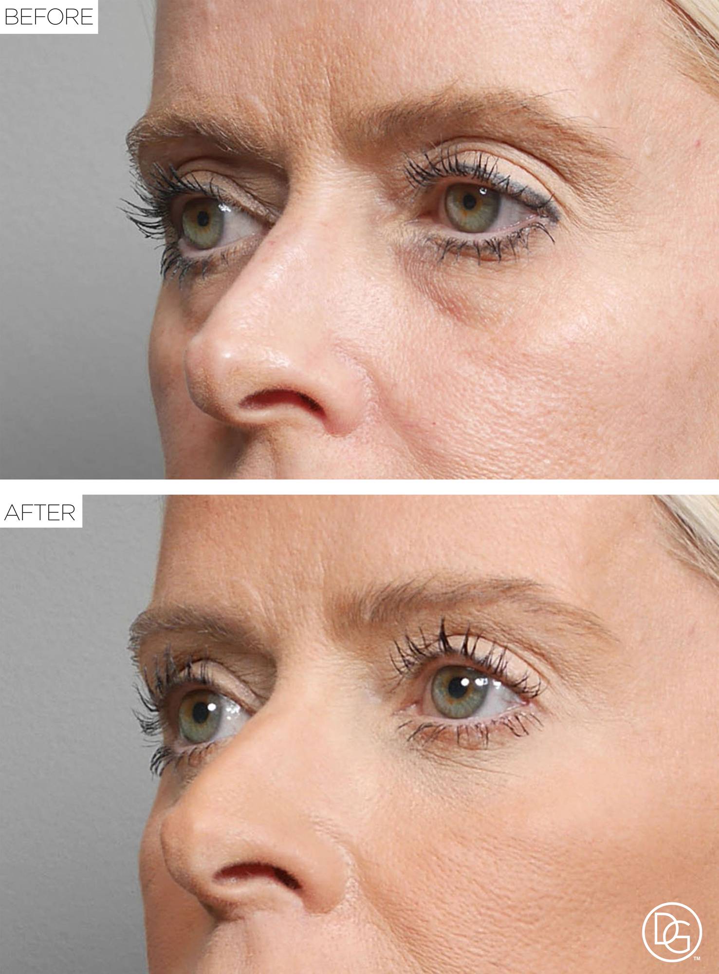 Before & After Image
