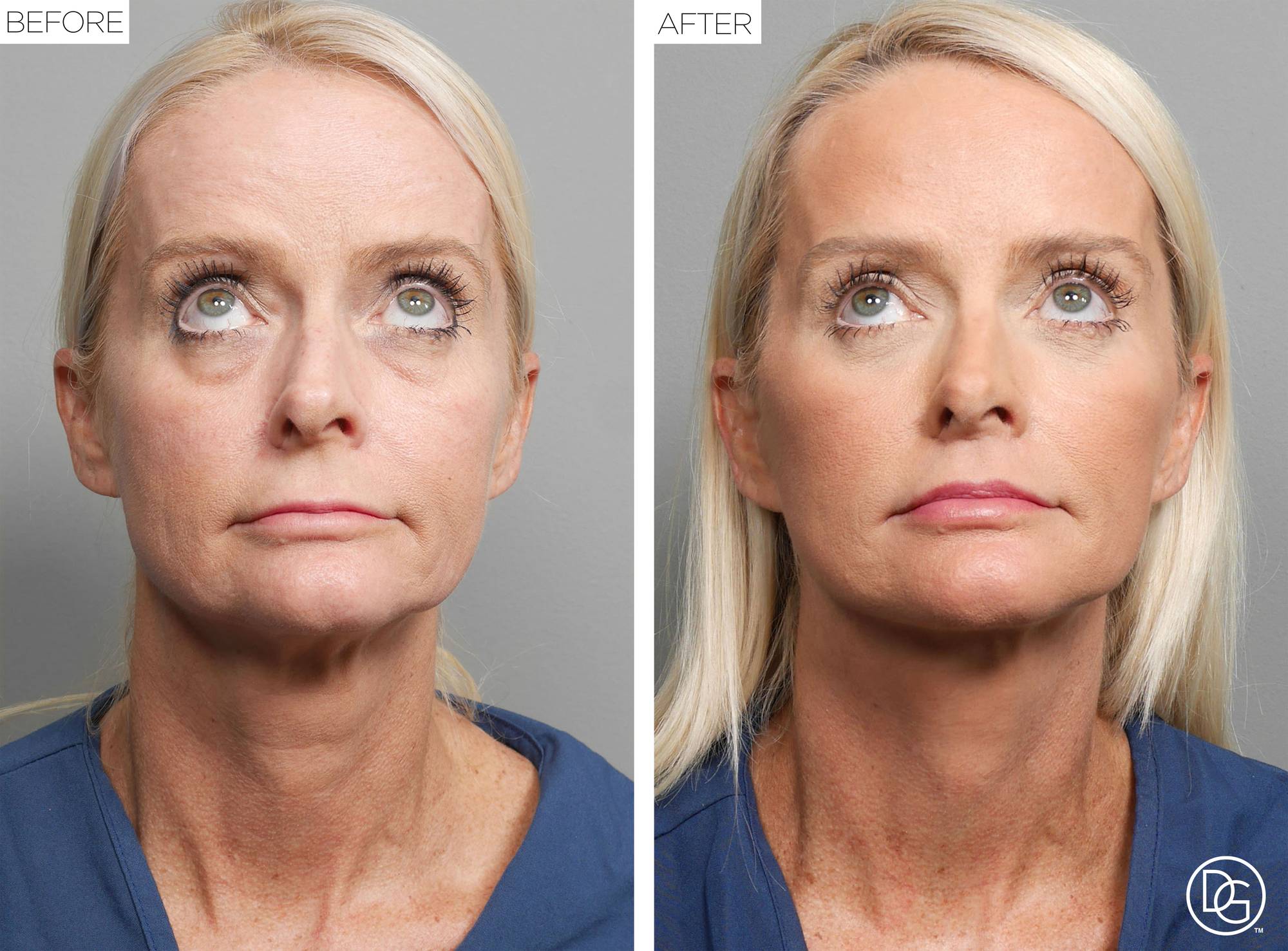 Before & After Image
