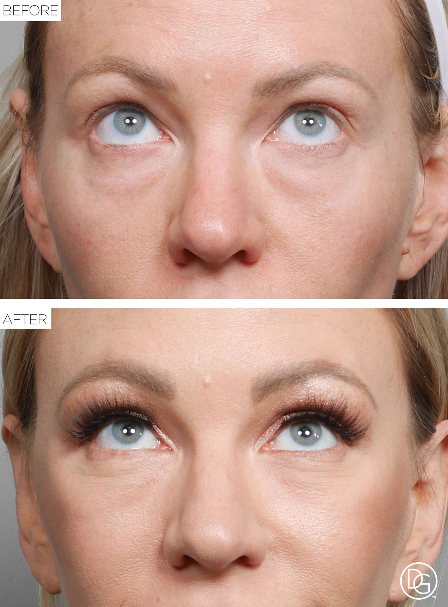 Before & After Image