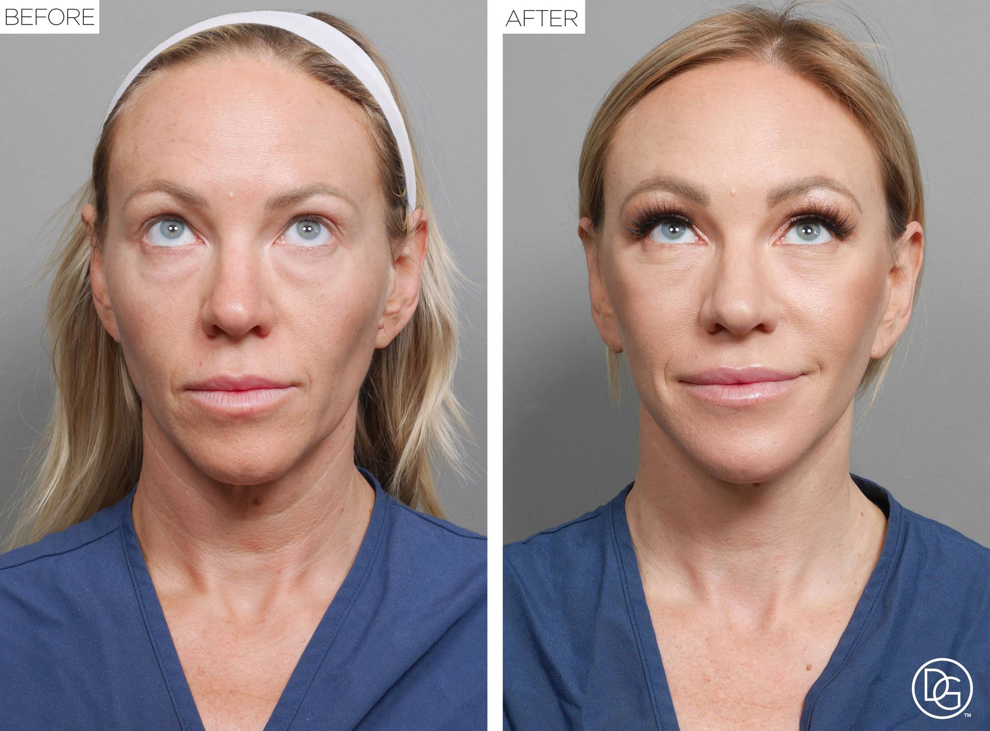Before & After Image