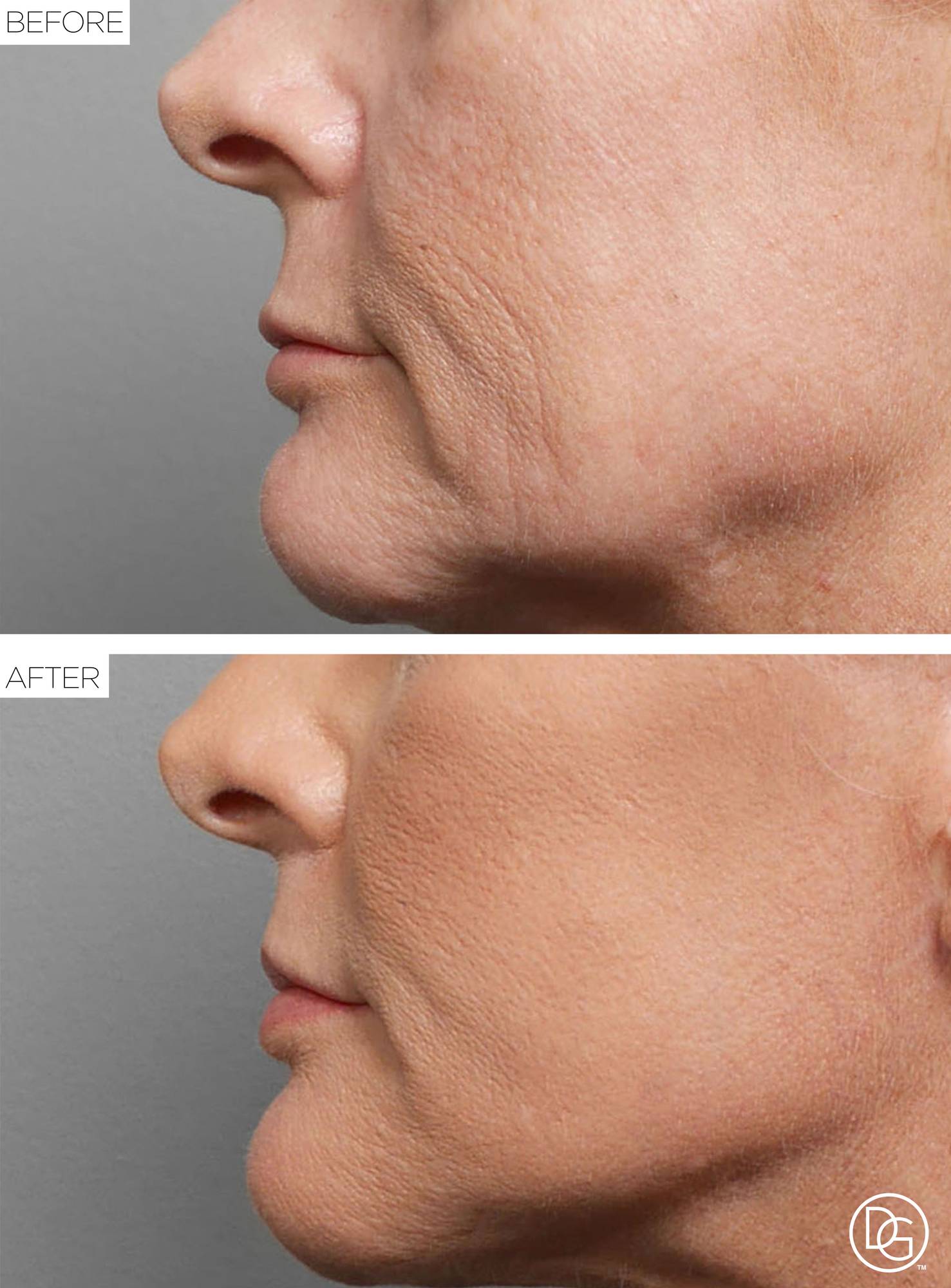 Before & After Image