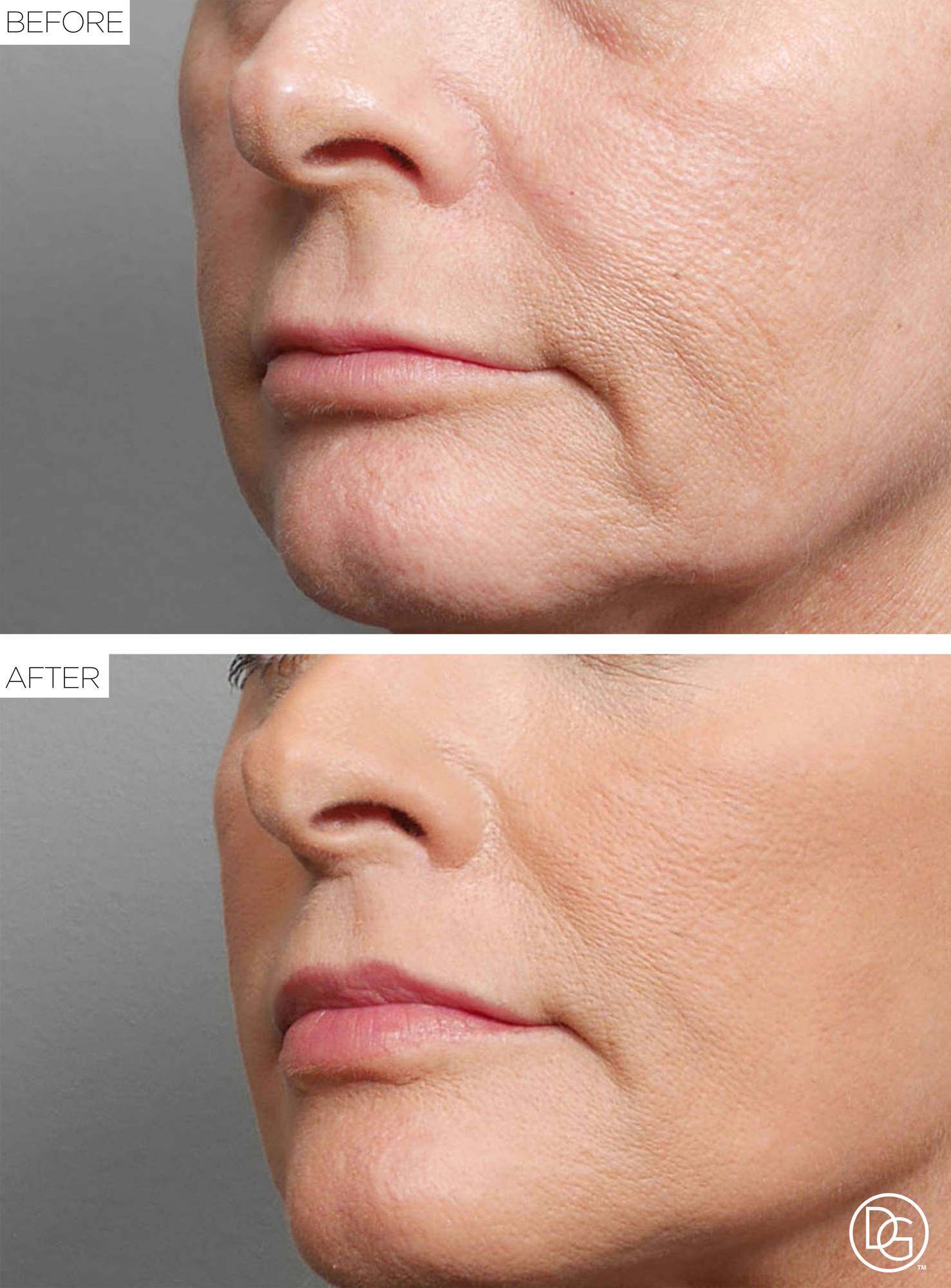 Before & After Image