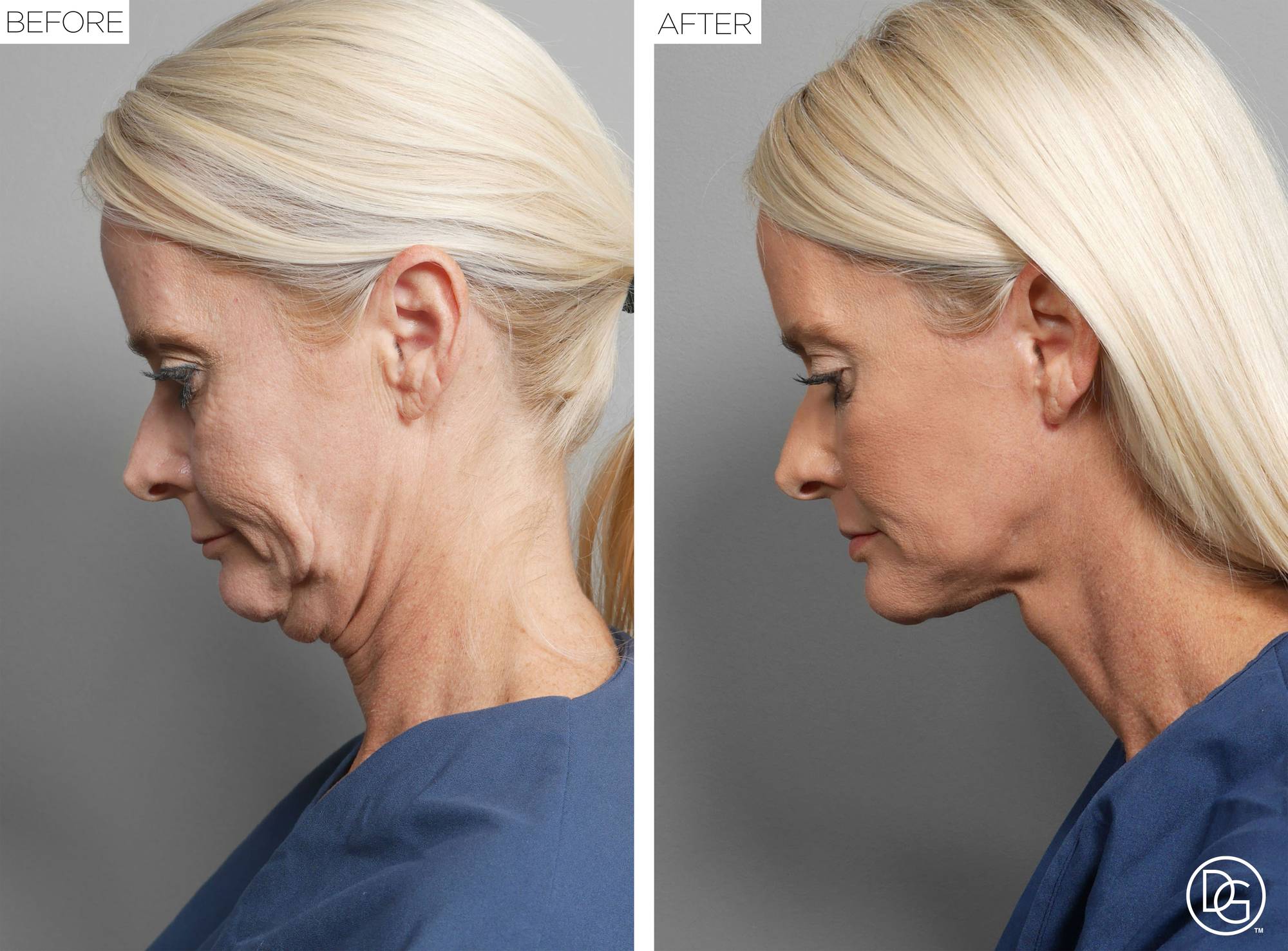 Before & After Image