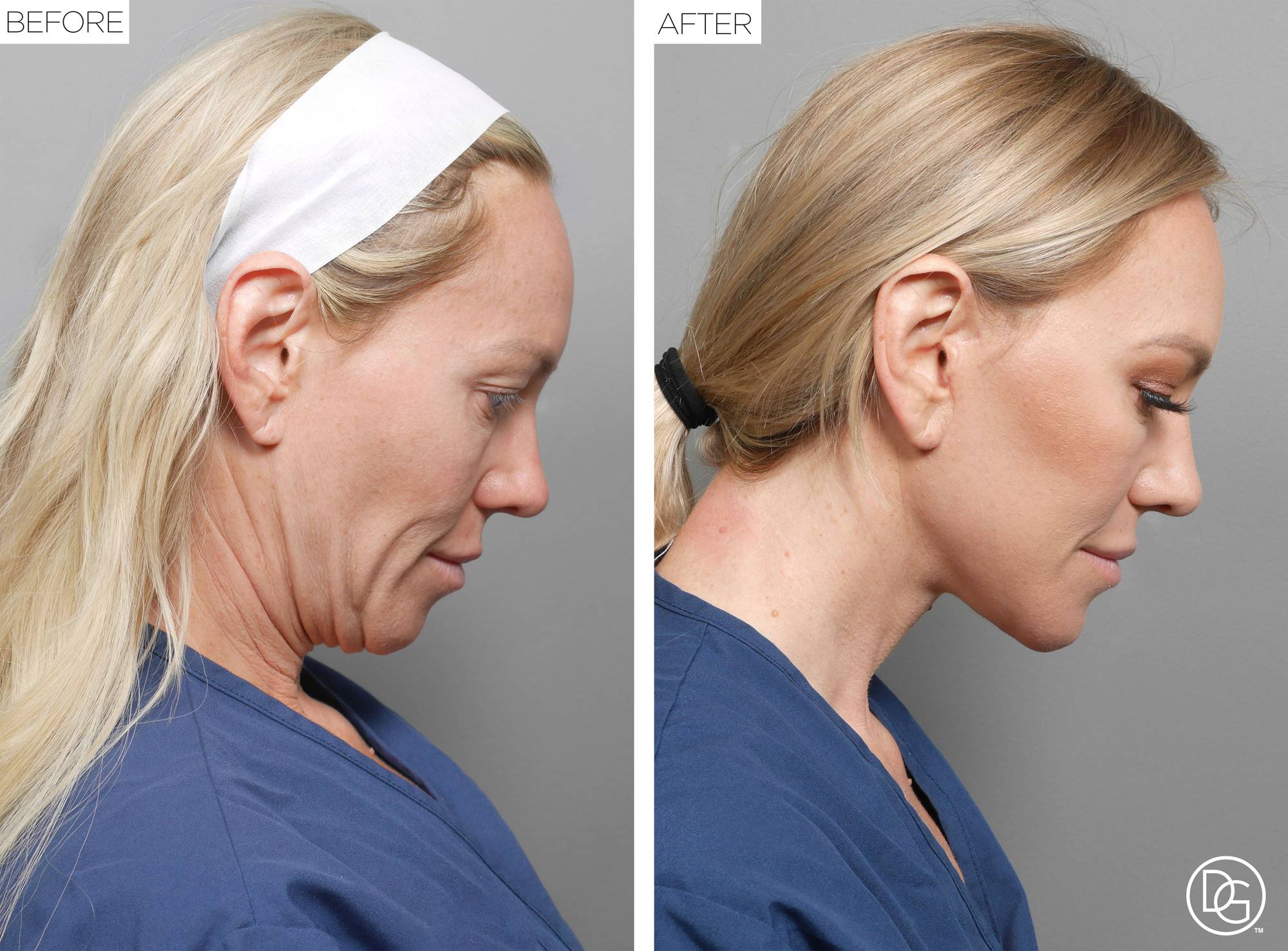 Before & After Image