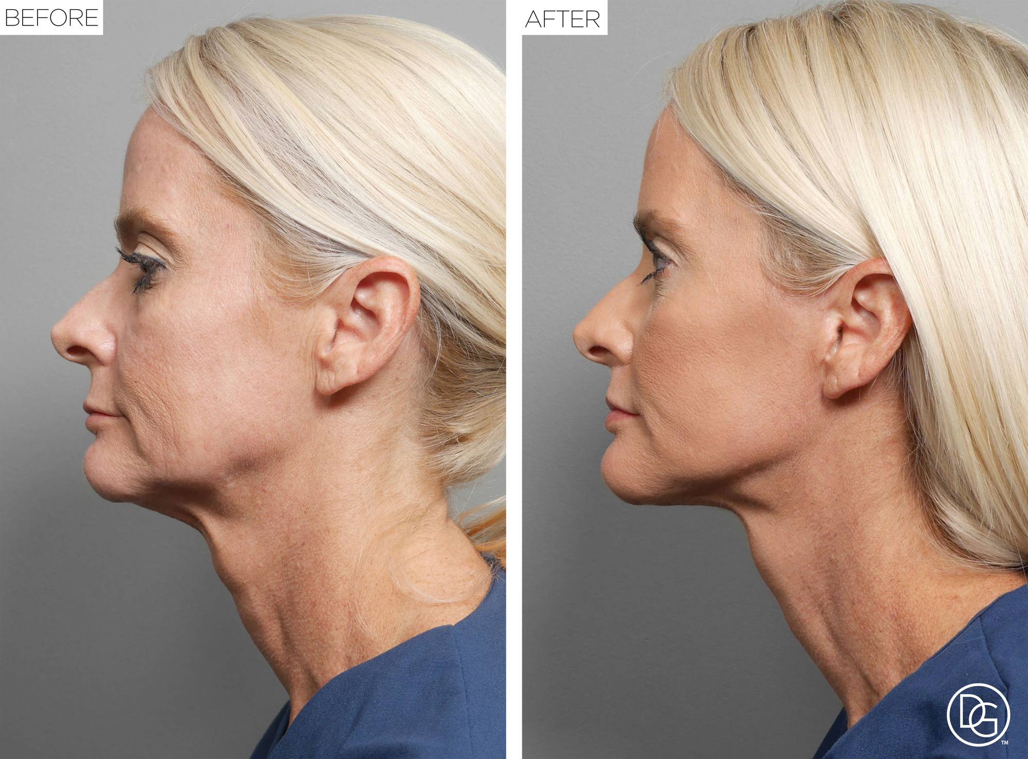 Before & After Image