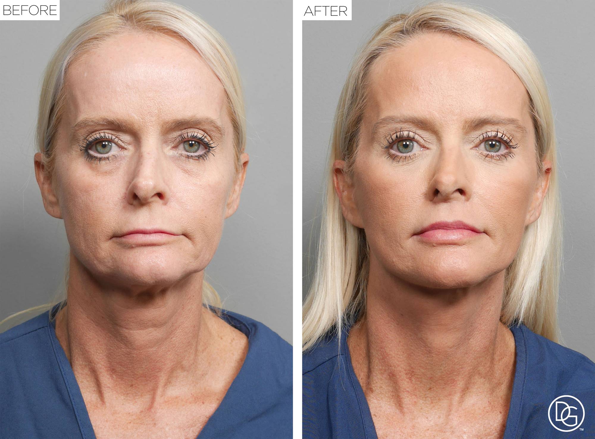 Before & After Image