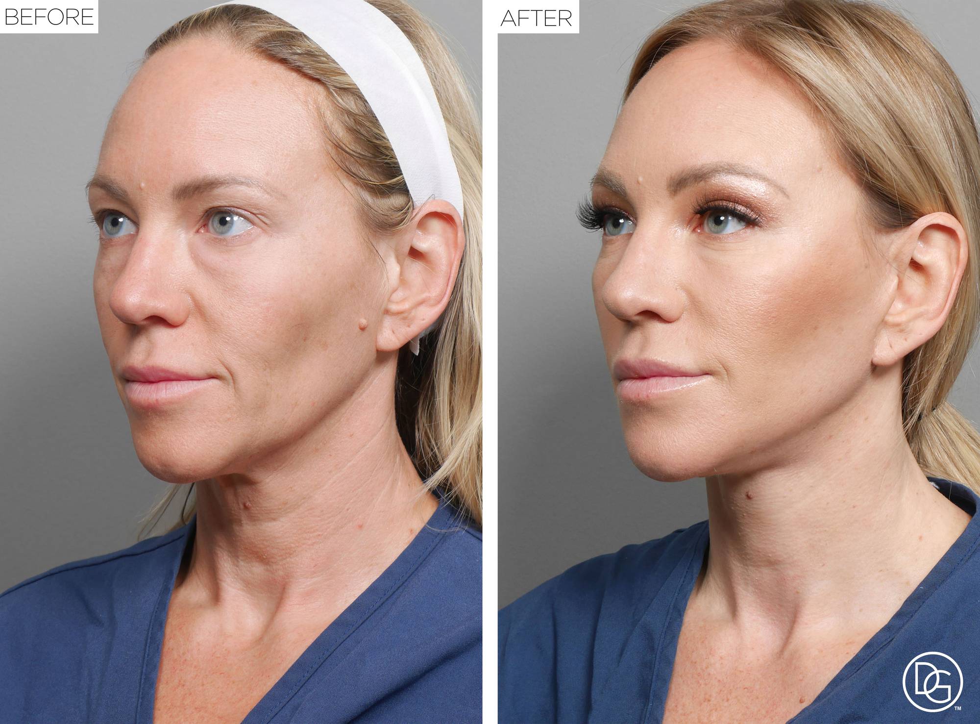 Before & After Image