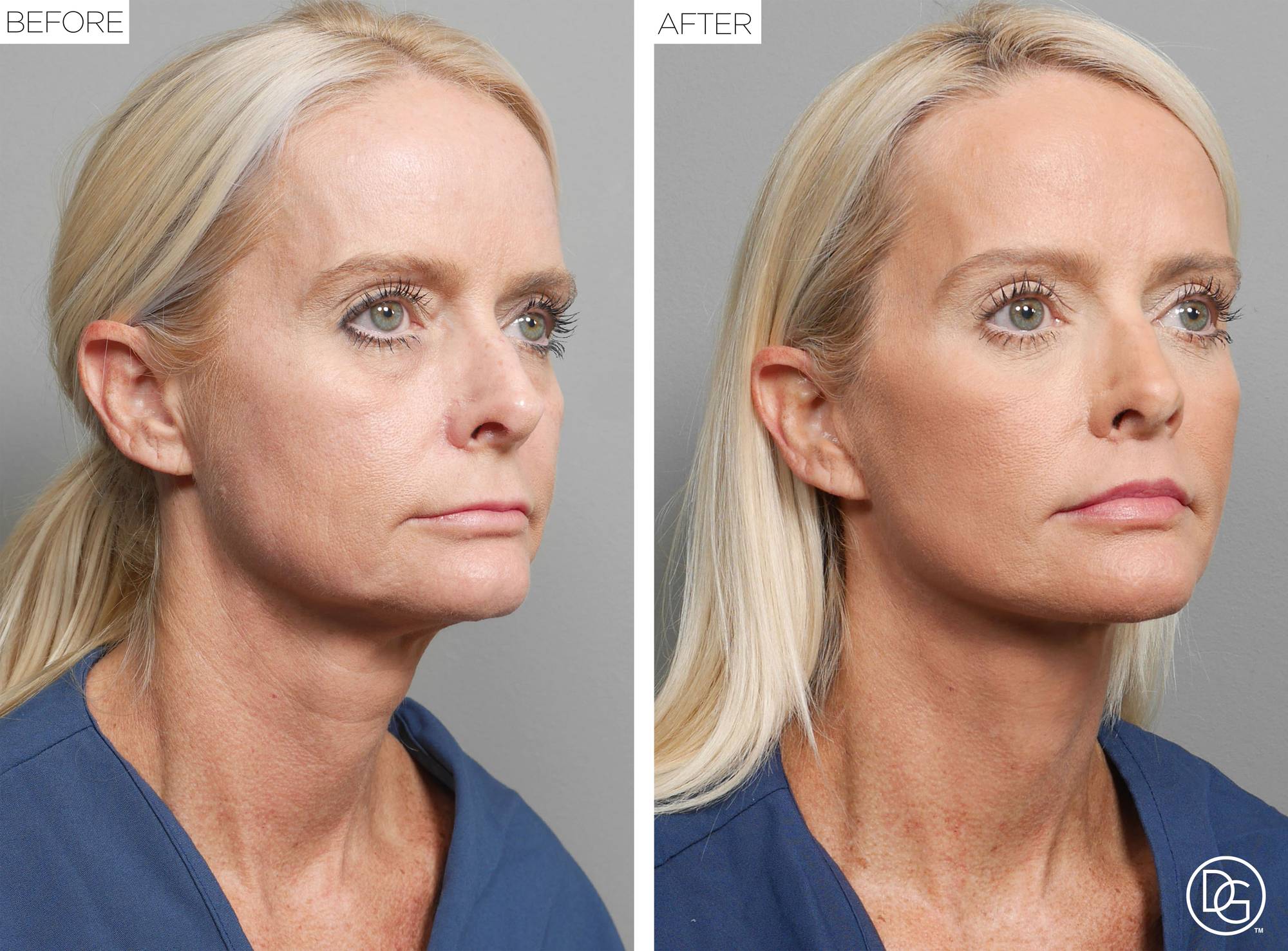 Before & After Image