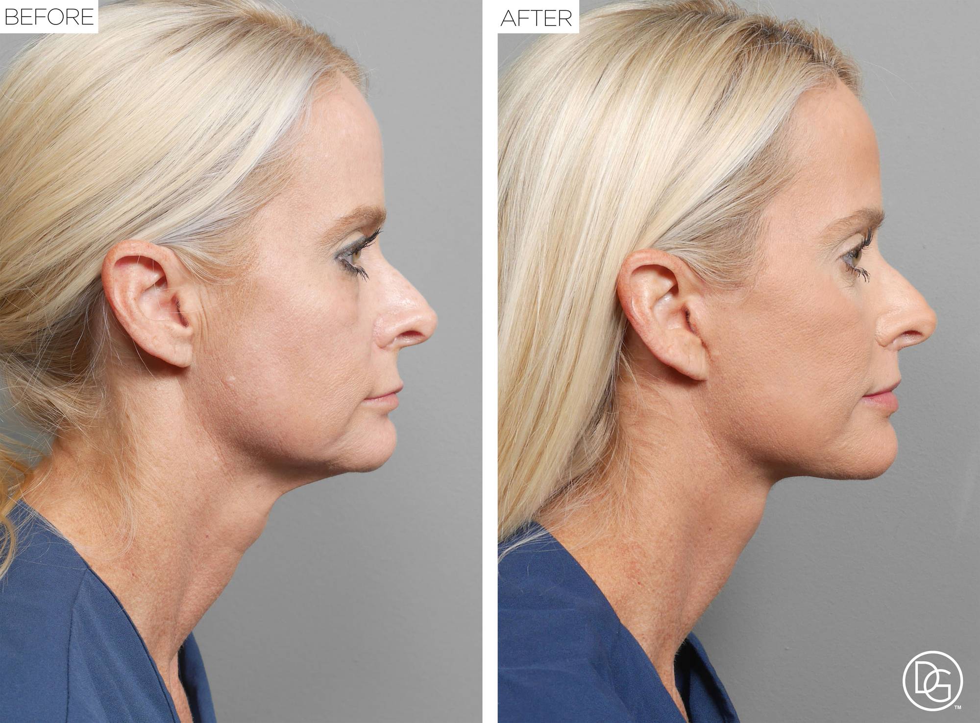 Before & After Image