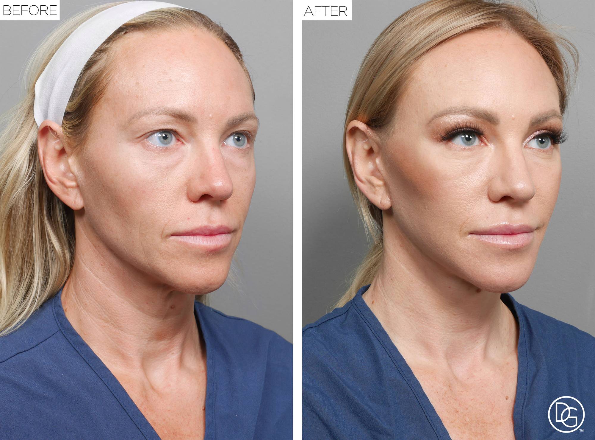 Before & After Image