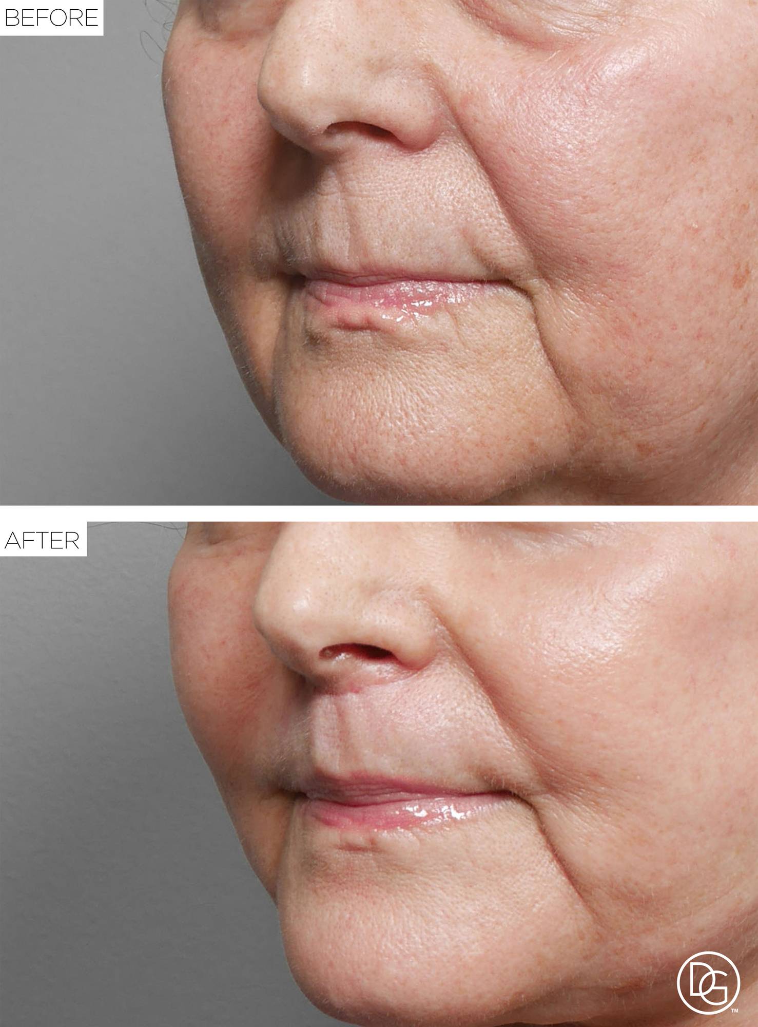 Before & After Image