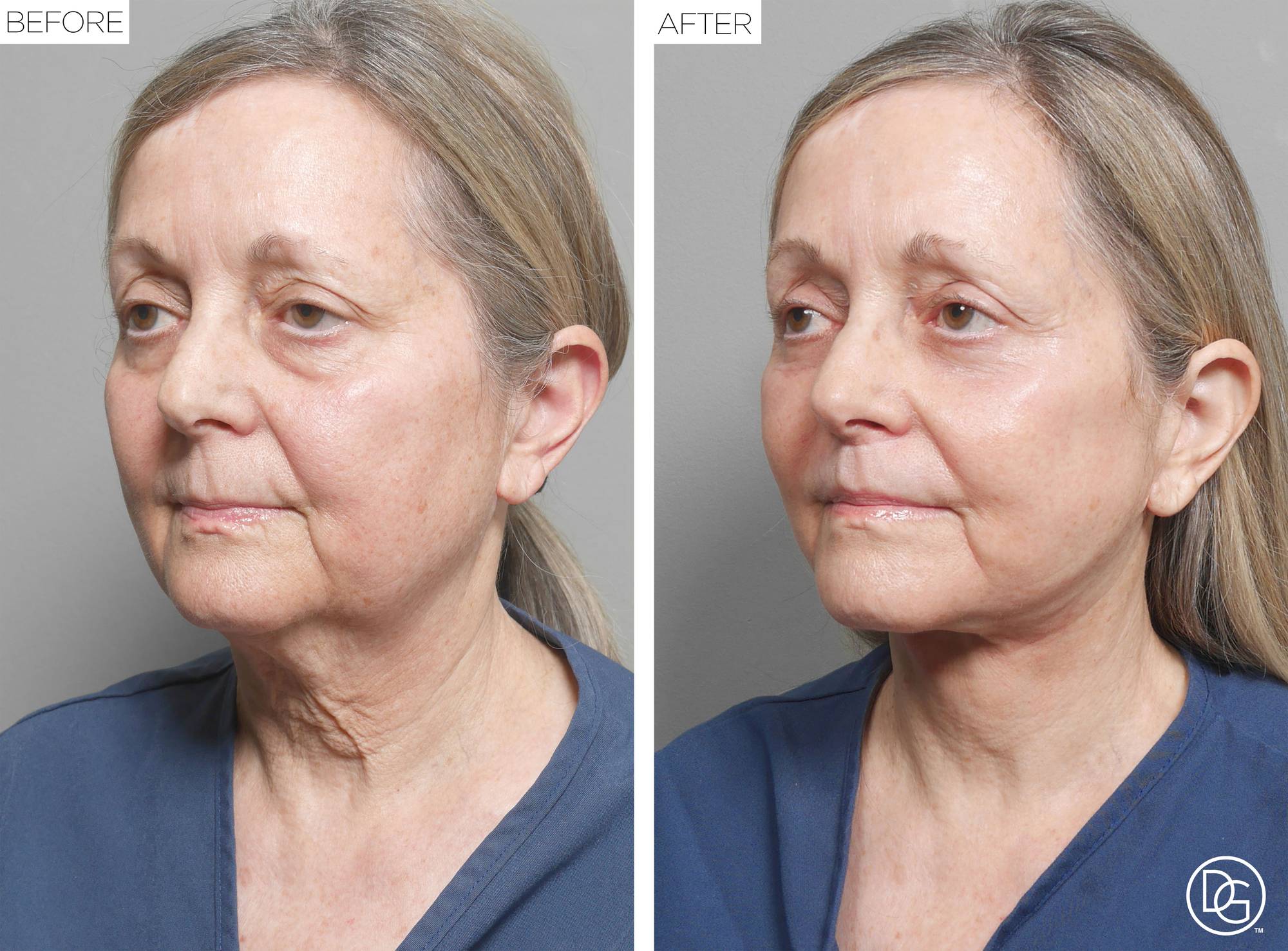 Before & After Image