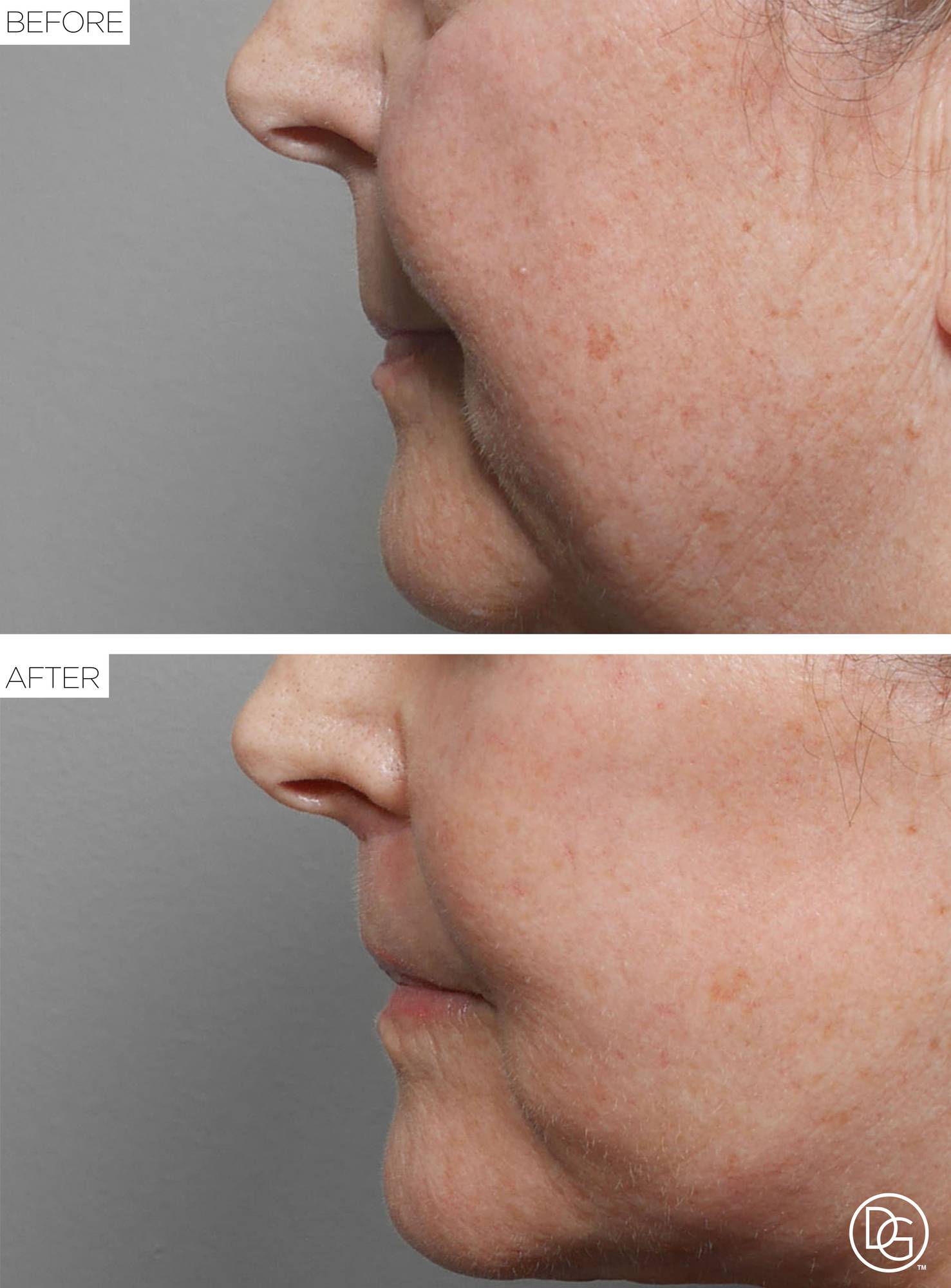 Before & After Image