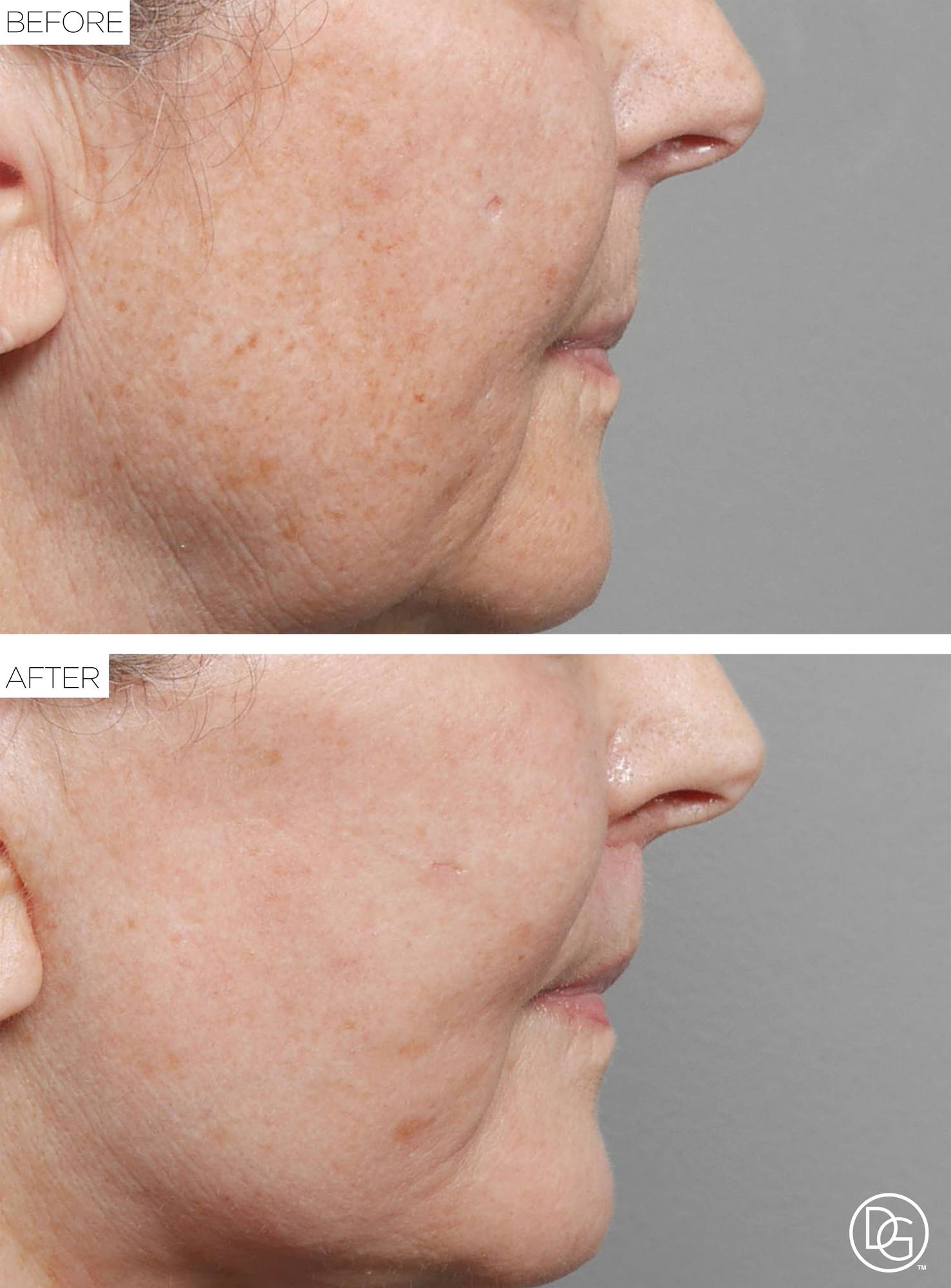 Before & After Image