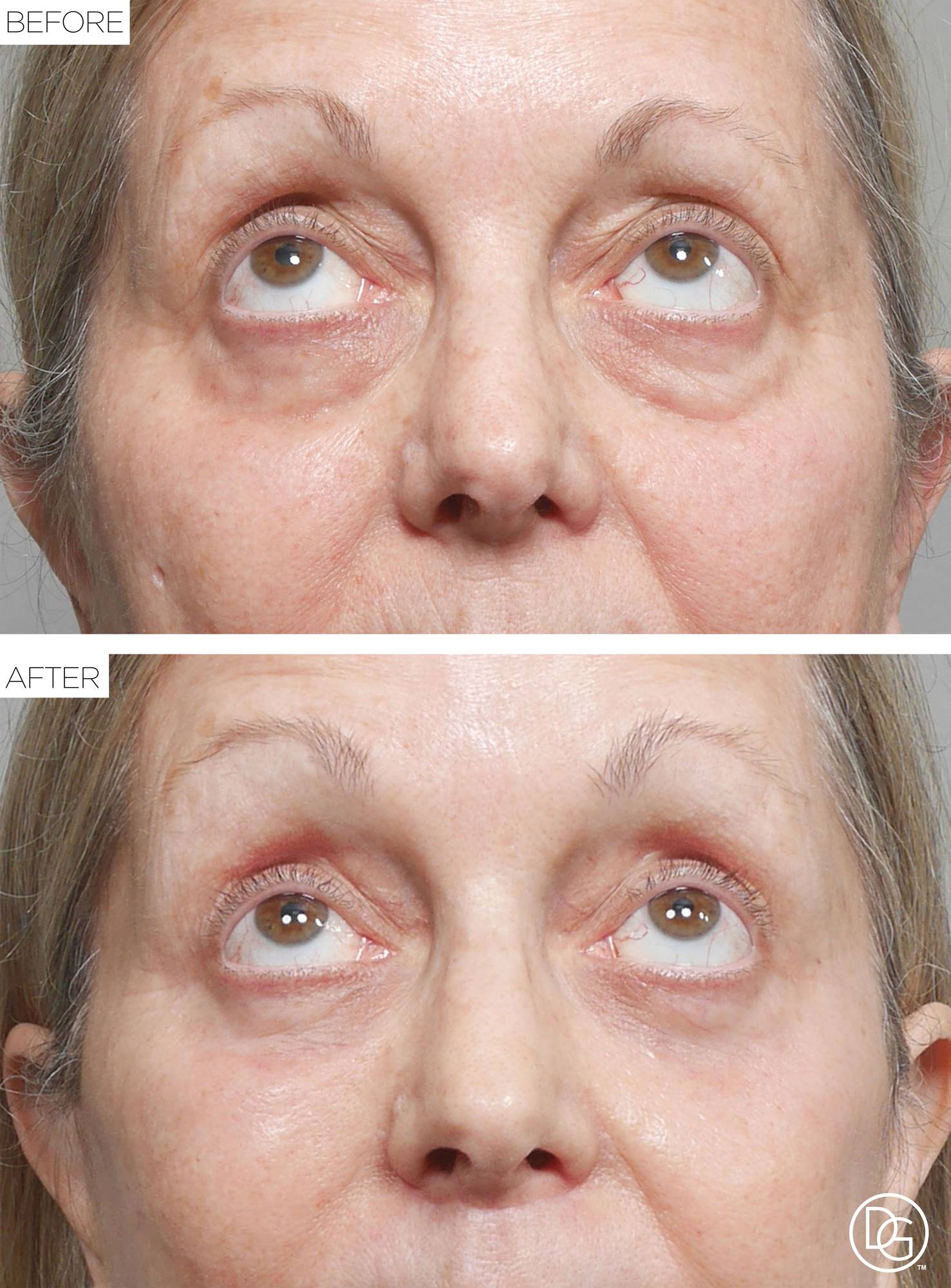 Before & After Image