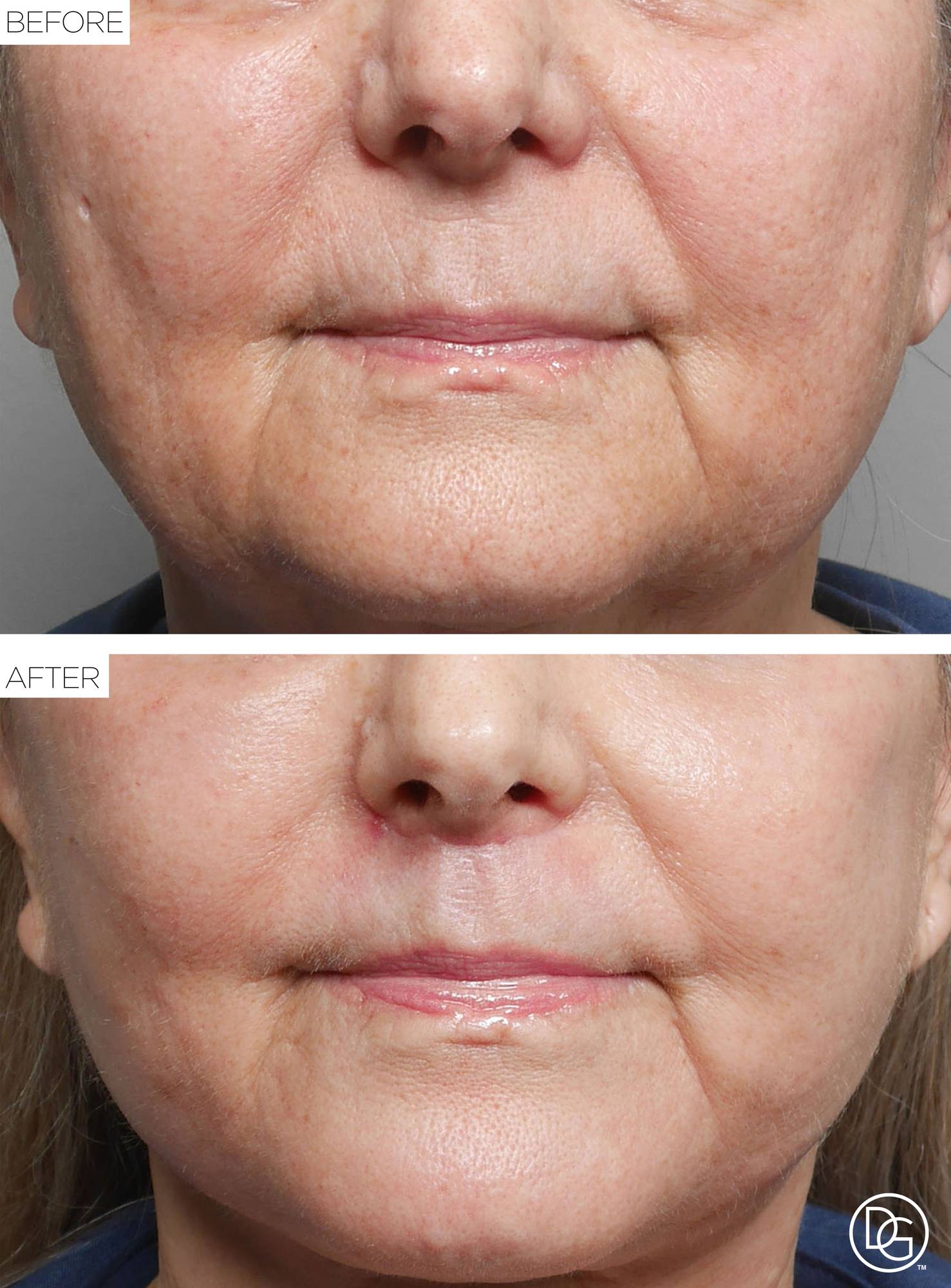 Before & After Image