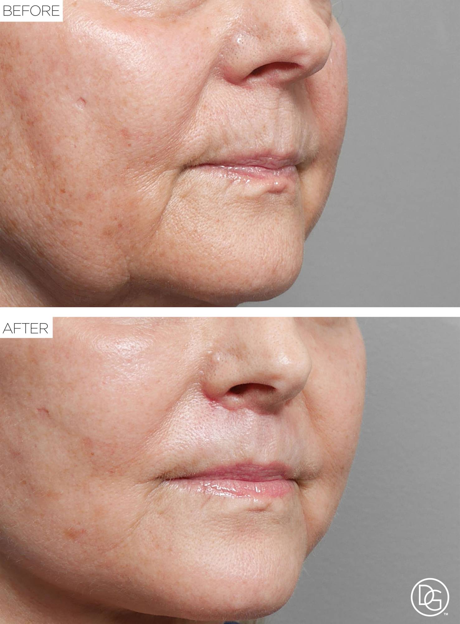 Before & After Image