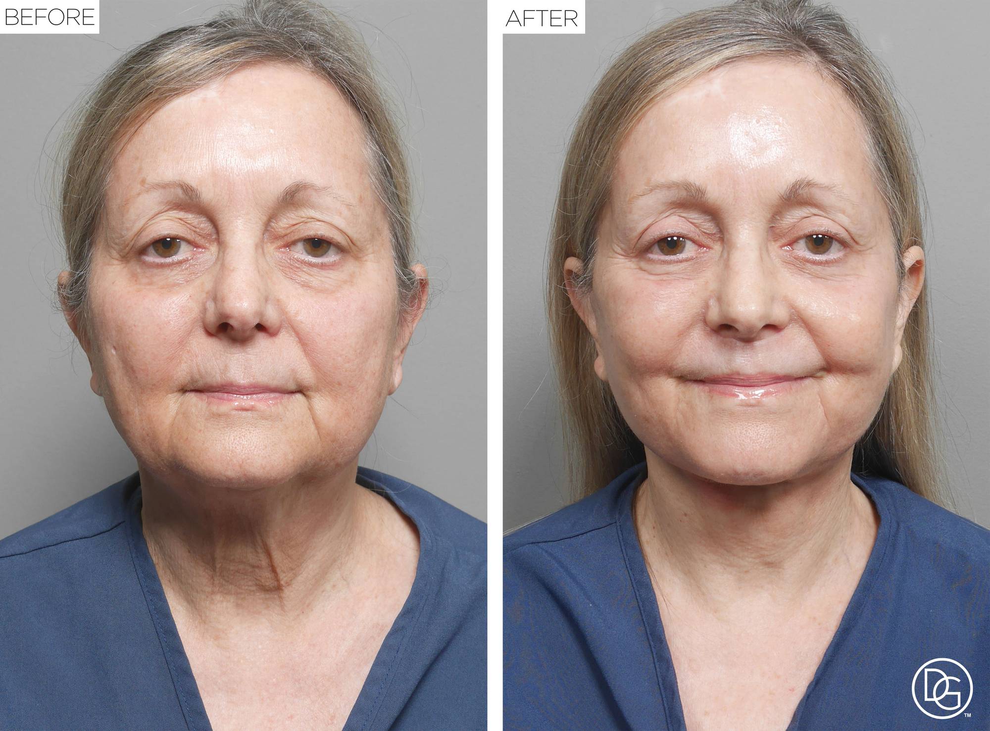 Before & After Image