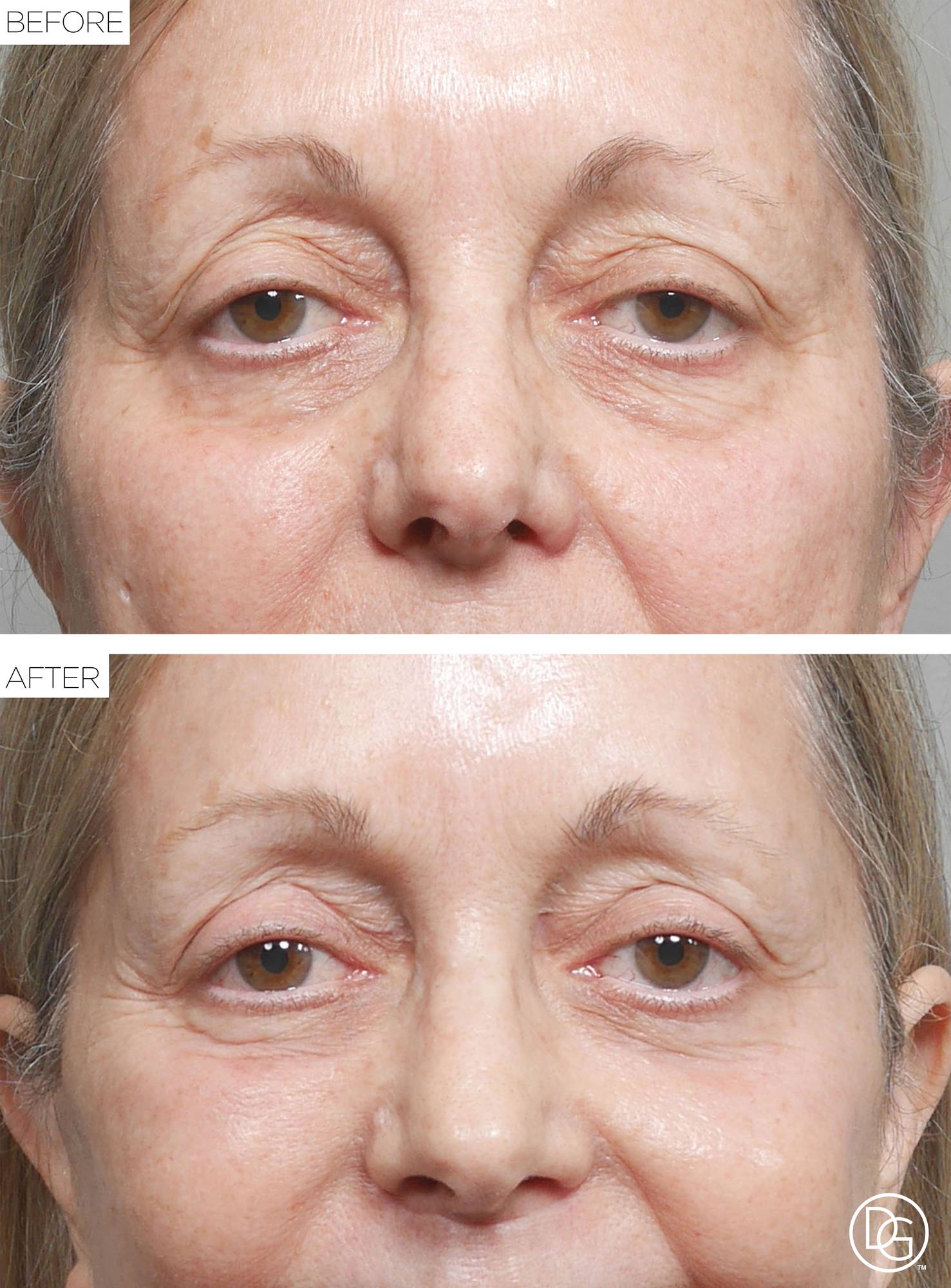 Before & After Image