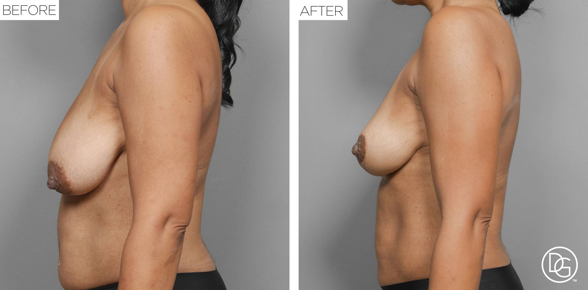 Before & After Image