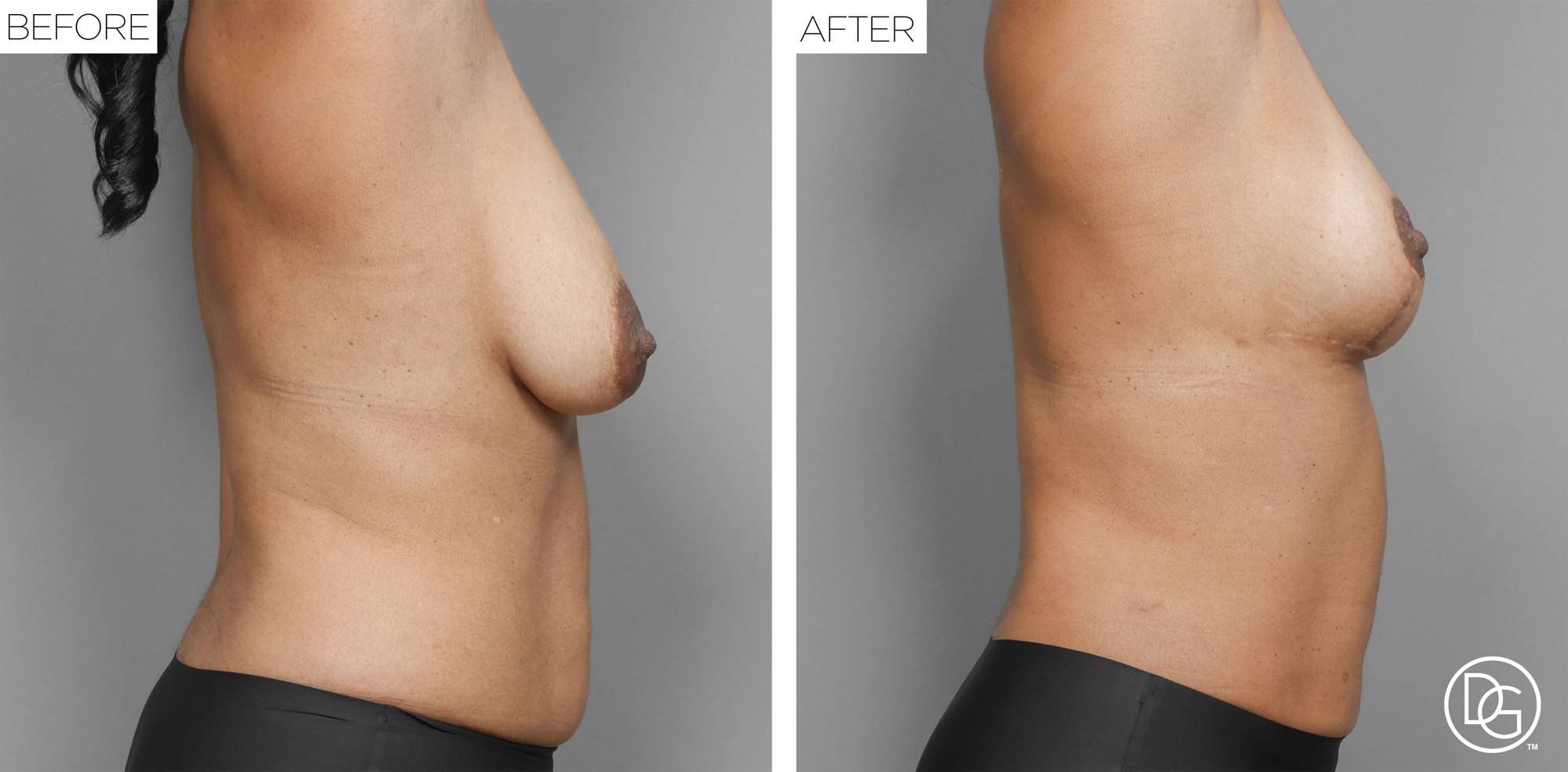 Before & After Image