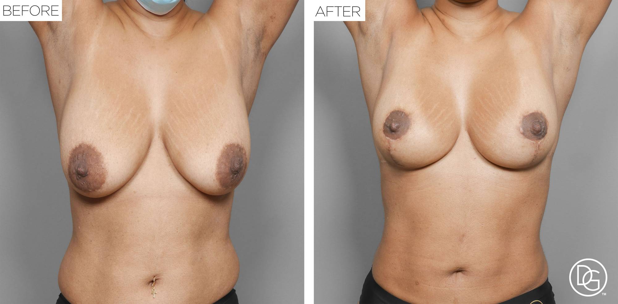 Before & After Image