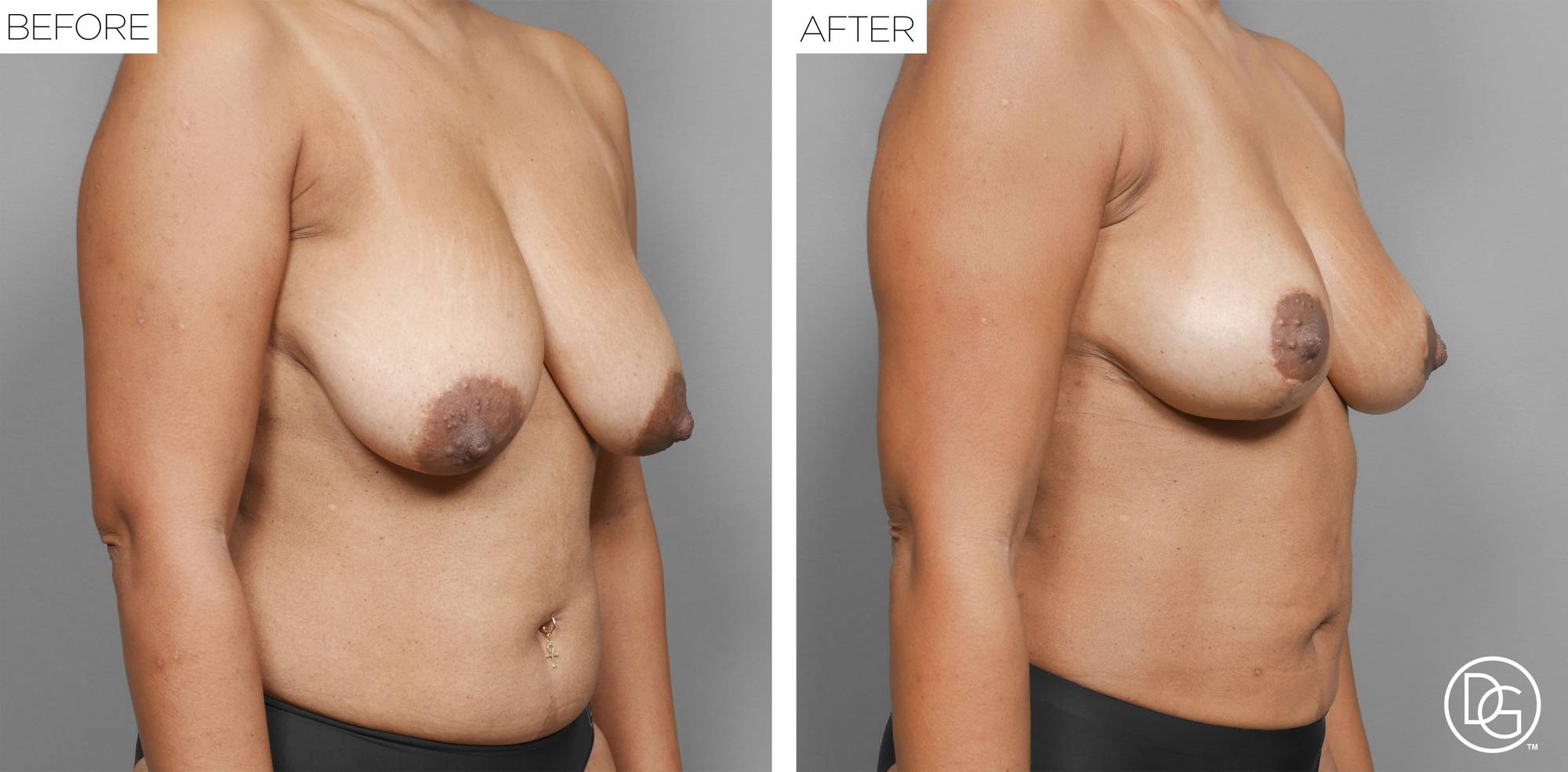 Before & After Image