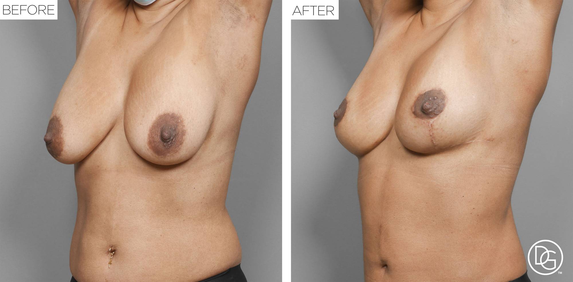 Before & After Image